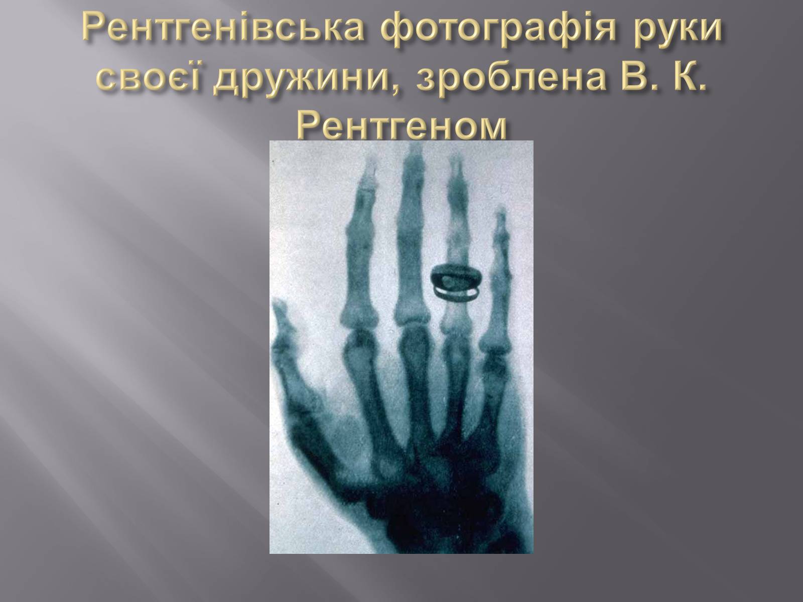 Презентація на тему «Рентгенівське випромінювання» (варіант 4) - Слайд #5 Презентація на тему «Рентгенівське випромінювання» (варіант 4) - Слайд #5
