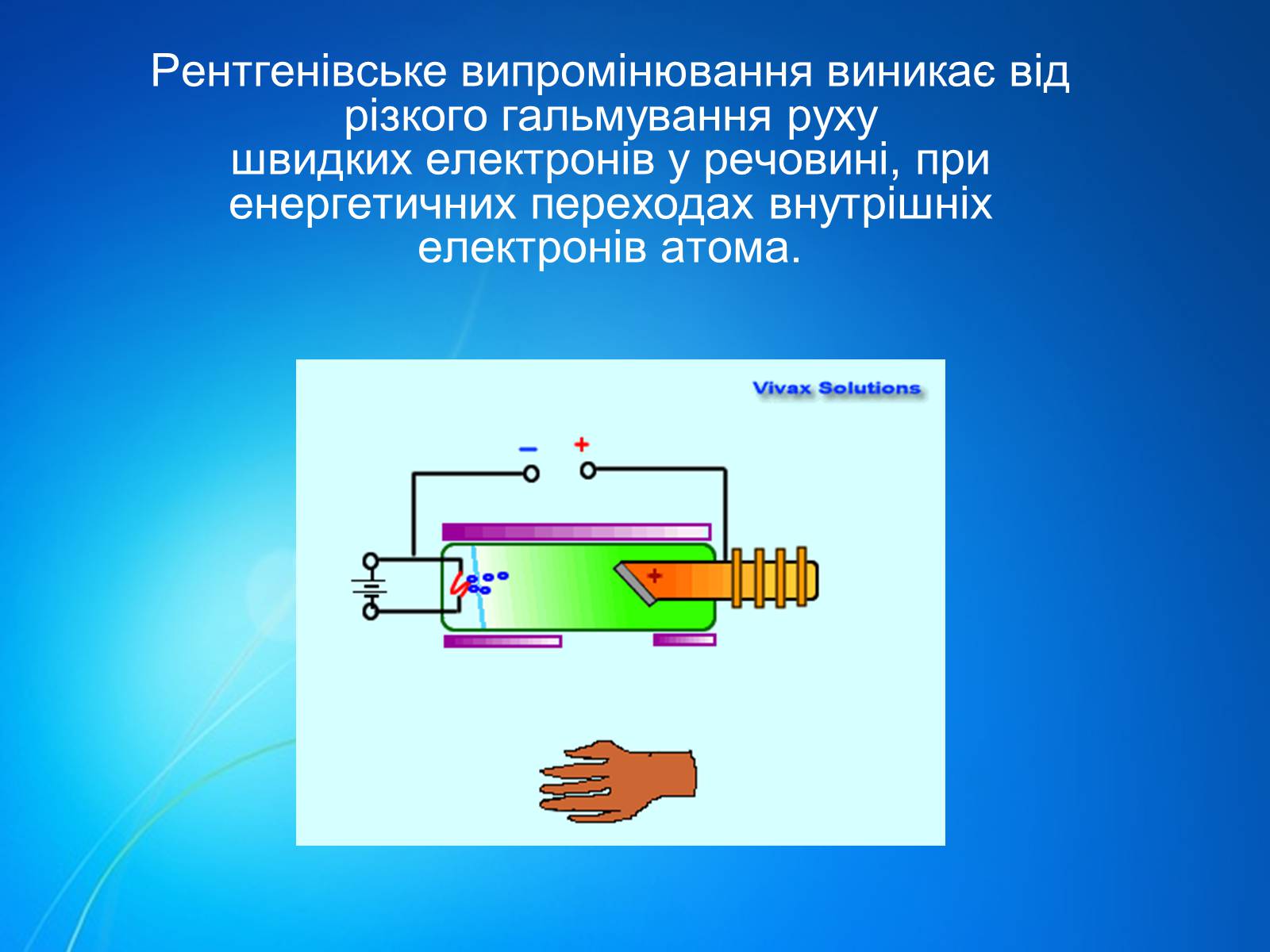 Презентація на тему «Рентгенівське випромінювання» (варіант 7) - Слайд #3 Презентація на тему «Рентгенівське випромінювання» (варіант 7) - Слайд #3