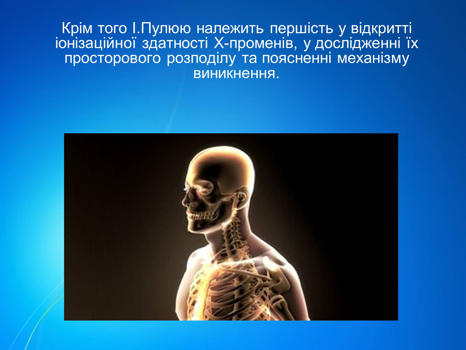 Презентація на тему «Рентгенівське випромінювання» (варіант 7) - Слайд #6 Презентація на тему «Рентгенівське випромінювання» (варіант 7) - Слайд #6