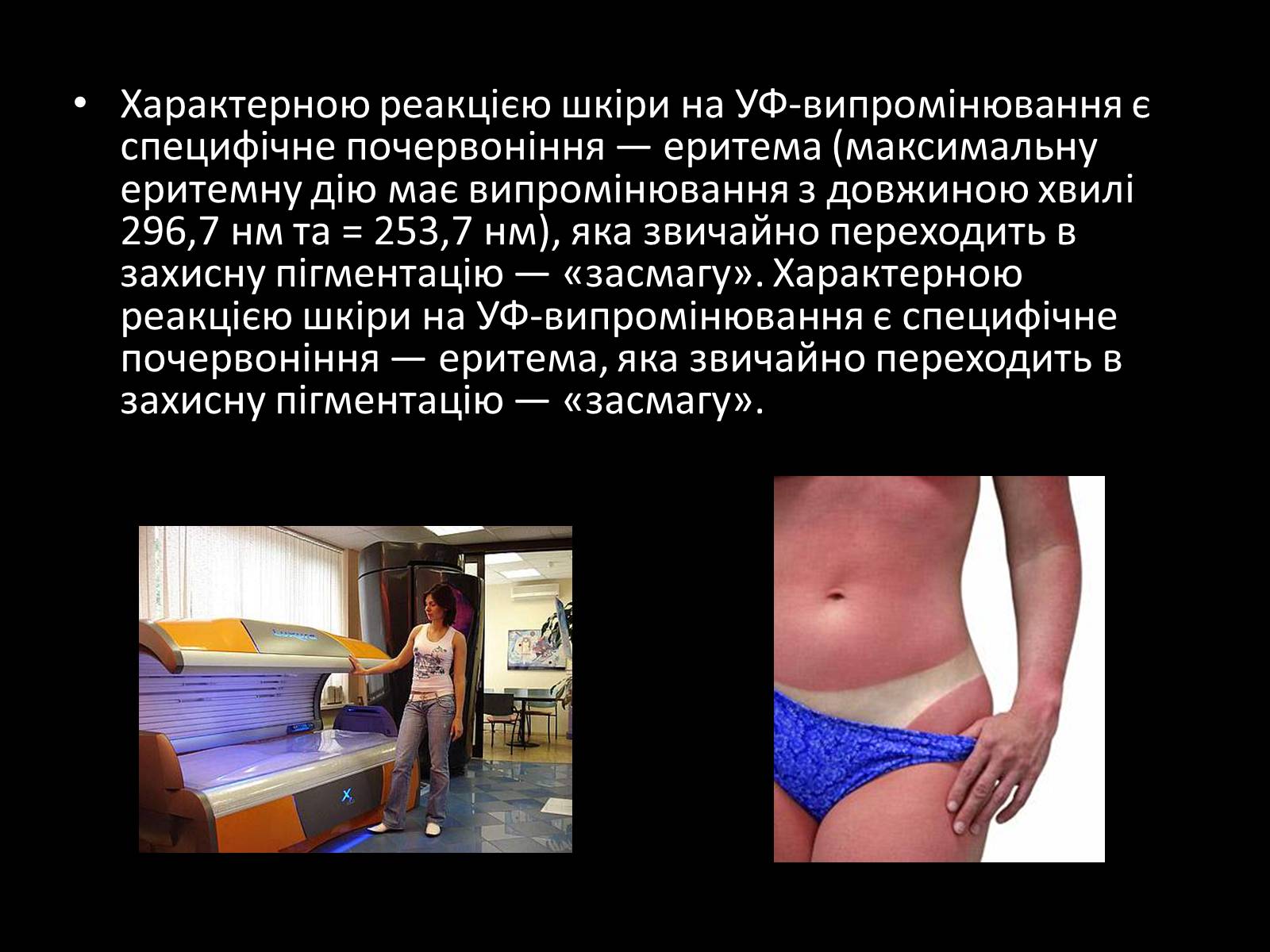 Презентація на тему «Ультрафіолетове випромінювання» (варіант 3) - Слайд #11 Презентація на тему «Ультрафіолетове випромінювання» (варіант 3) - Слайд #11