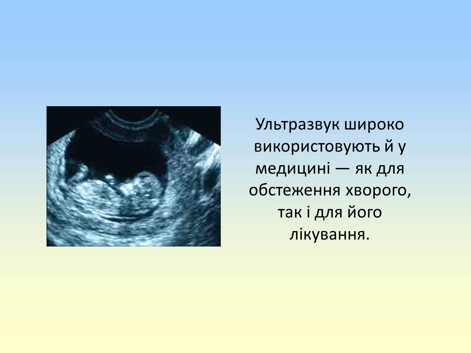 Презентація на тему «Гучність звуку. Висота і тембр звуку» - Слайд #11 Презентація на тему «Гучність звуку. Висота і тембр звуку» - Слайд #11