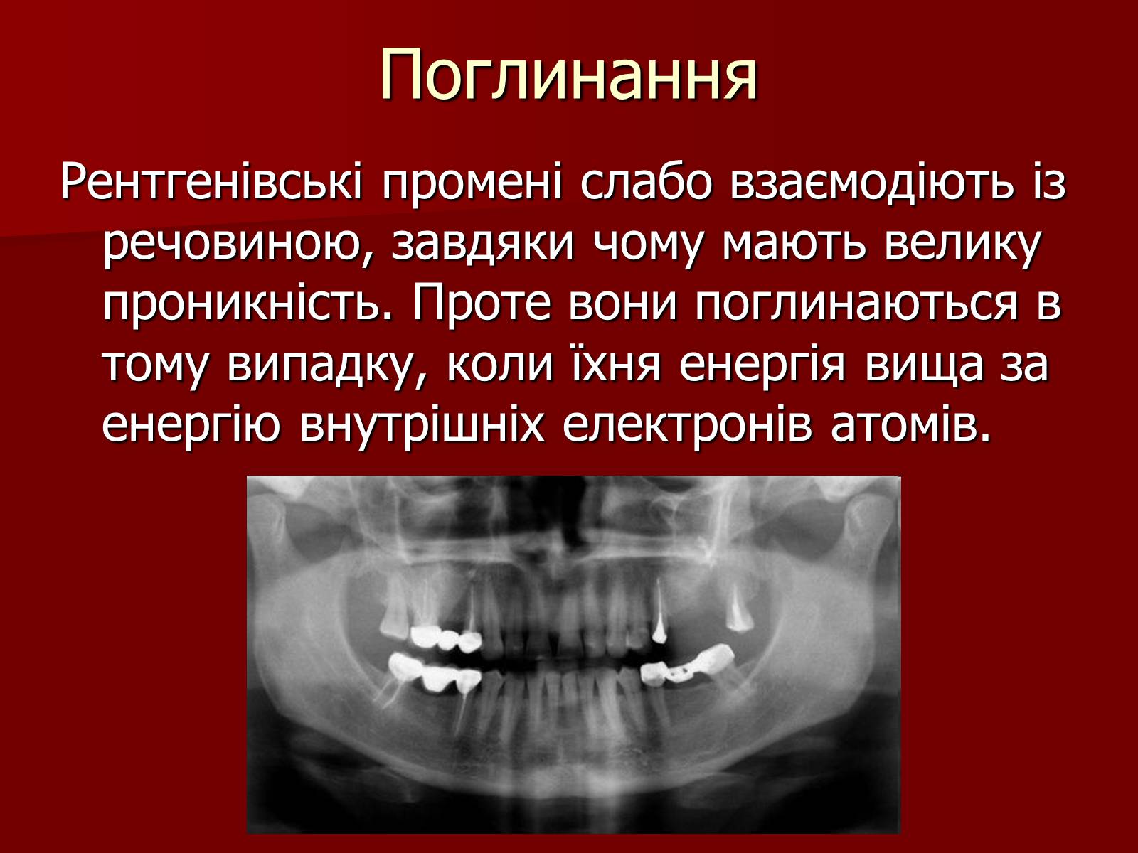 Презентація на тему «Рентгенівське випромінювання» (варіант 3) - Слайд #11 Презентація на тему «Рентгенівське випромінювання» (варіант 3) - Слайд #11