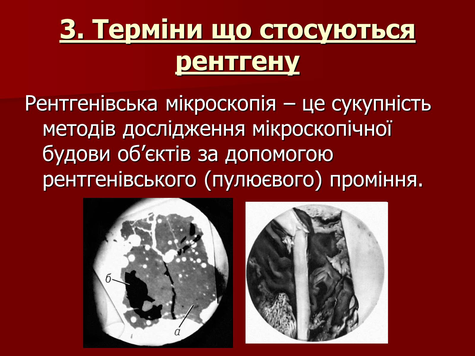 Презентація на тему «Рентгенівське випромінювання» (варіант 3) - Слайд #15 Презентація на тему «Рентгенівське випромінювання» (варіант 3) - Слайд #15