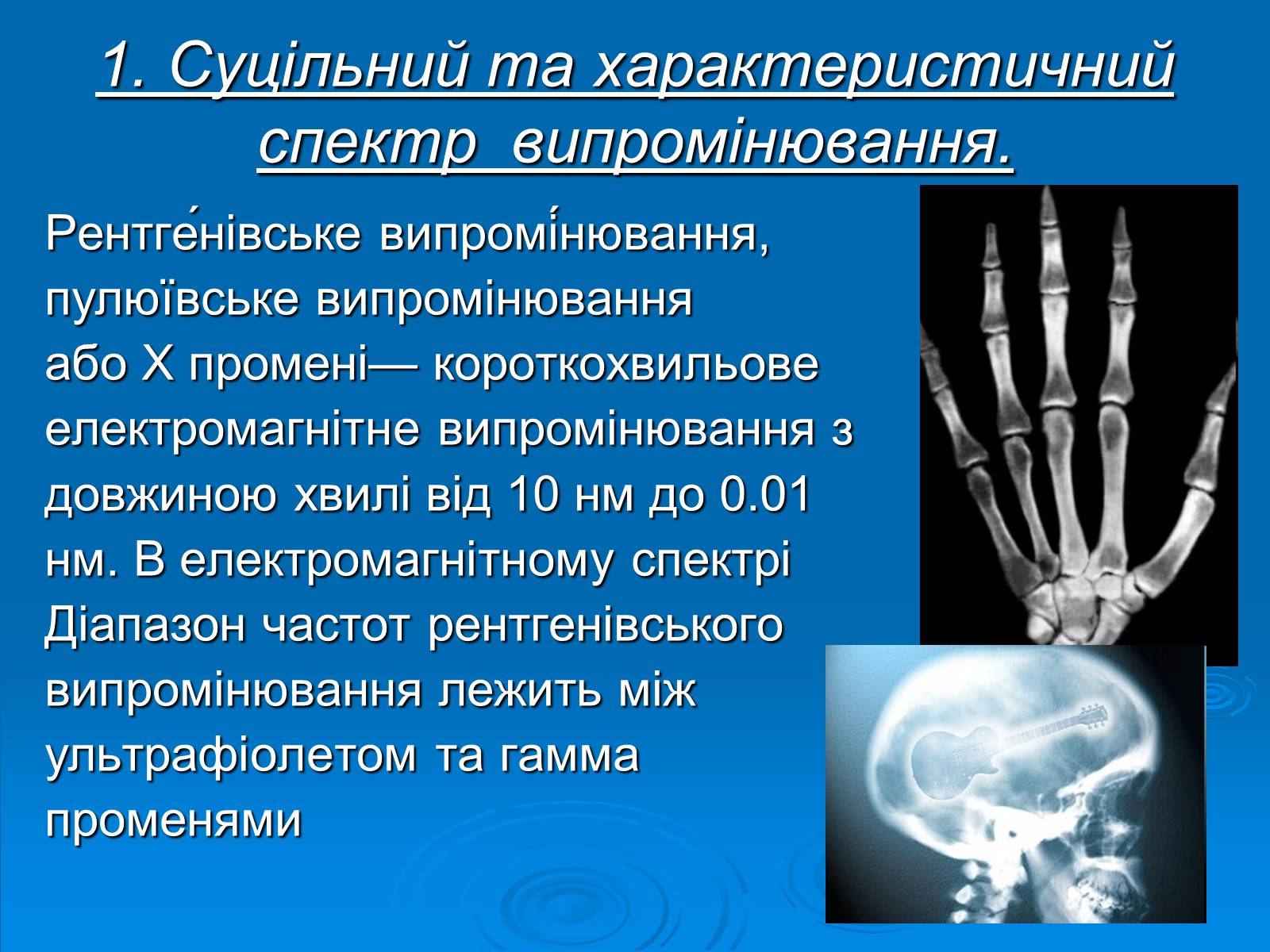 Презентація на тему «Рентгенівське випромінювання» (варіант 3) - Слайд #3 Презентація на тему «Рентгенівське випромінювання» (варіант 3) - Слайд #3