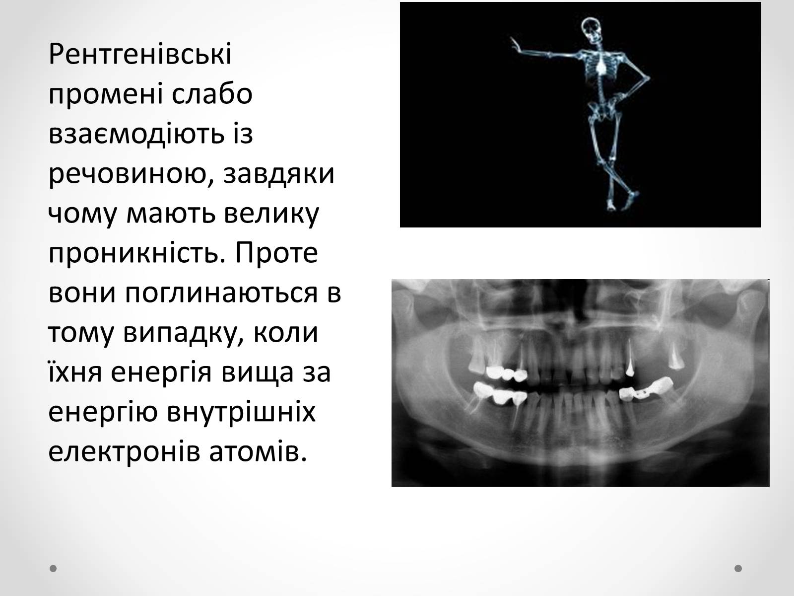 Презентація на тему «Рентгенівське випромінювання» (варіант 8) - Слайд #10 Презентація на тему «Рентгенівське випромінювання» (варіант 8) - Слайд #10