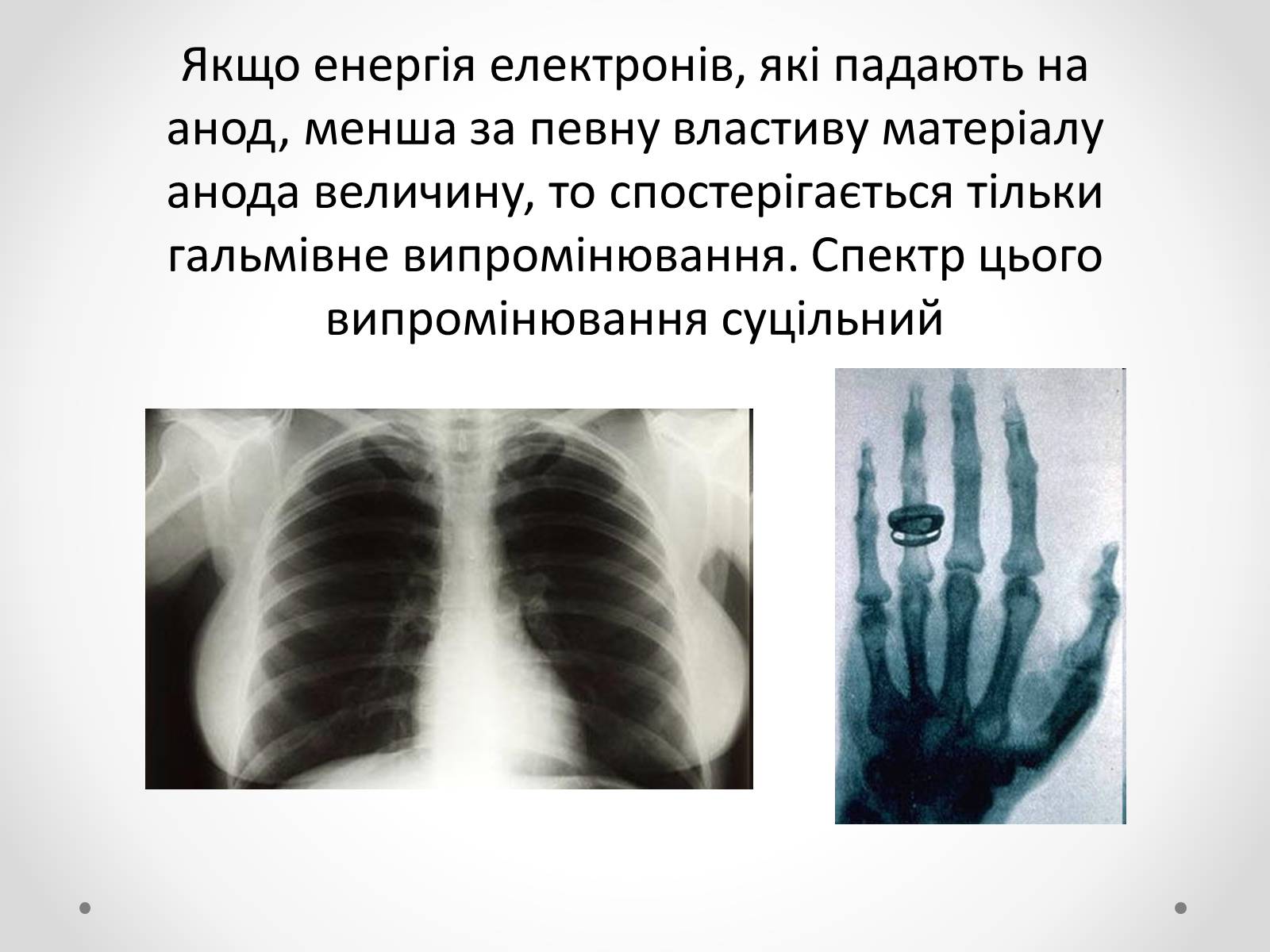 Презентація на тему «Рентгенівське випромінювання» (варіант 8) - Слайд #8 Презентація на тему «Рентгенівське випромінювання» (варіант 8) - Слайд #8