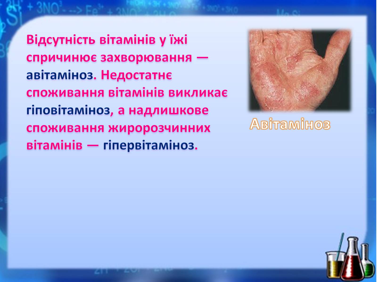 Презентація на тему «Жири, вуглеводи, білки, вітаміни як компоненти їжі» (варіант 1) - Слайд #36 Презентація на тему «Жири, вуглеводи, білки, вітаміни як компоненти їжі» (варіант 1) - Слайд #36