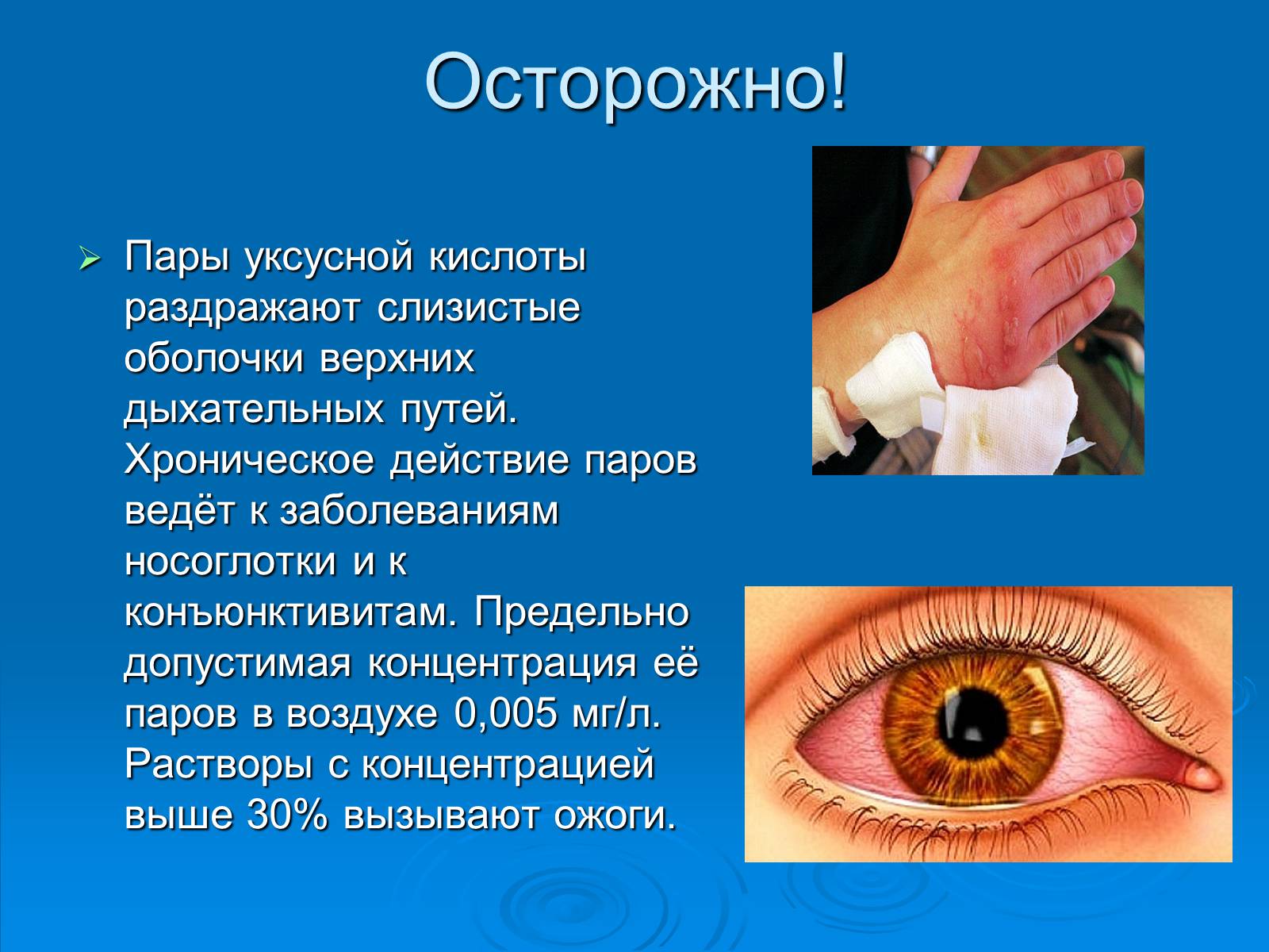 Презентація на тему «Уксусная кислота» (варіант 1) - Слайд #5 Презентація на тему «Уксусная кислота» (варіант 1) - Слайд #5