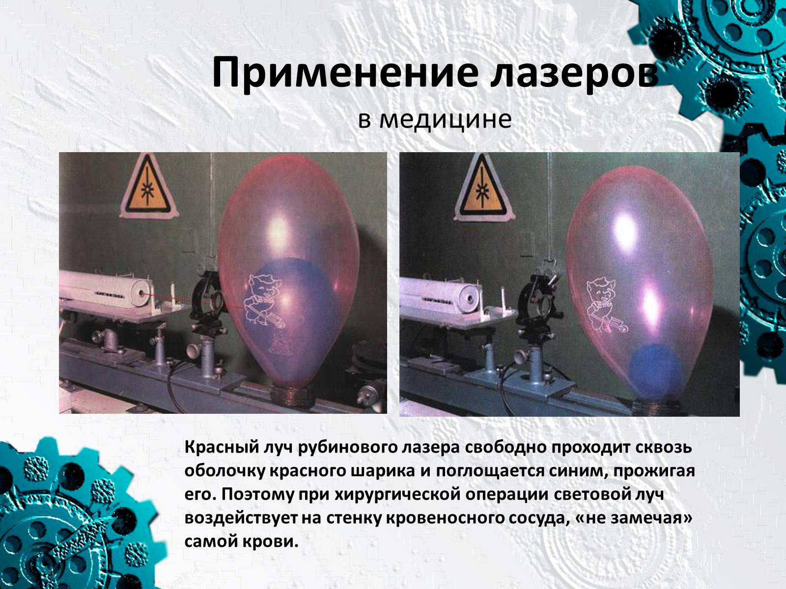 Презентація на тему «Применение лазеров» - Слайд #11 Презентація на тему «Применение лазеров» - Слайд #11