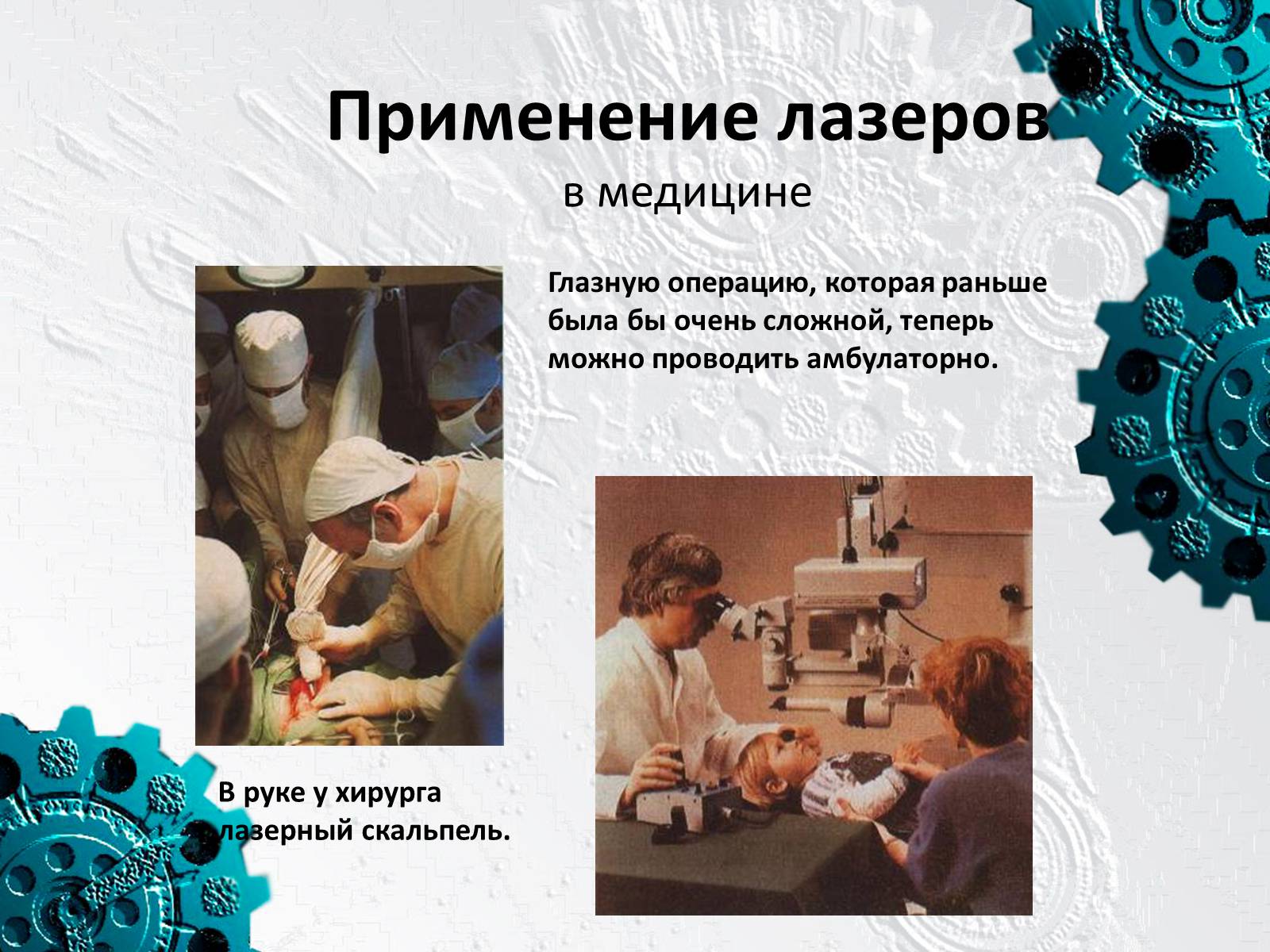 Презентація на тему «Применение лазеров» - Слайд #12 Презентація на тему «Применение лазеров» - Слайд #12