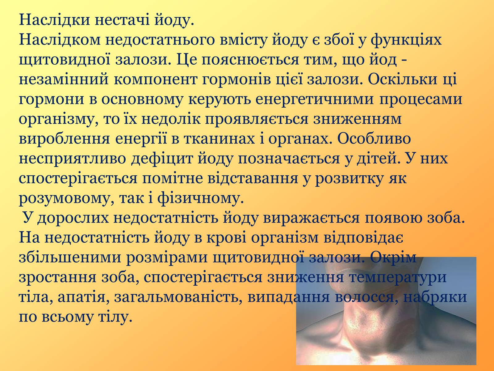 Презентація на тему «Раціональне харчування» (варіант 1) - Слайд #14 Презентація на тему «Раціональне харчування» (варіант 1) - Слайд #14