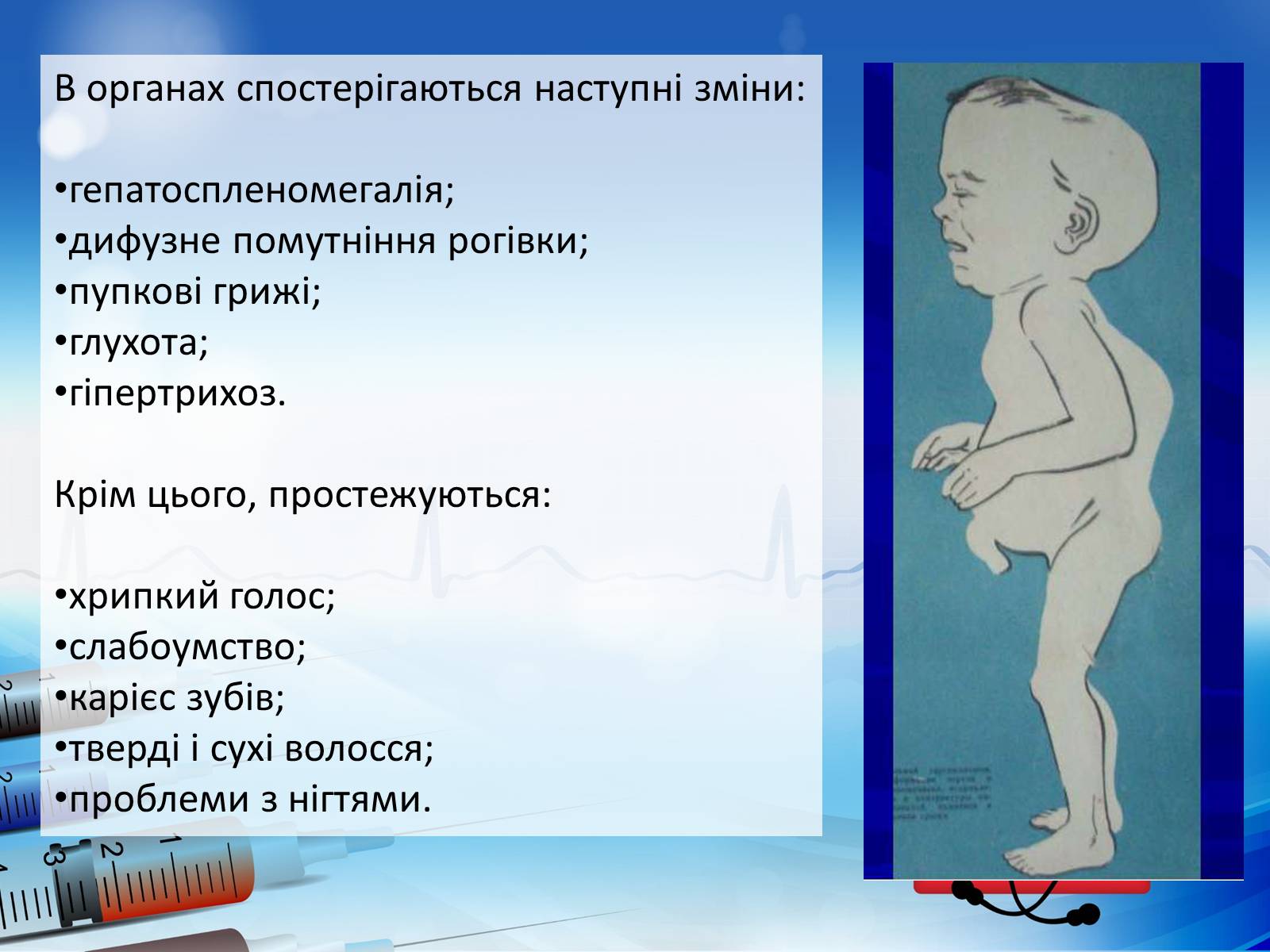 Презентація на тему «Спадкові хвороби» (варіант 2) - Слайд #12 Презентація на тему «Спадкові хвороби» (варіант 2) - Слайд #12