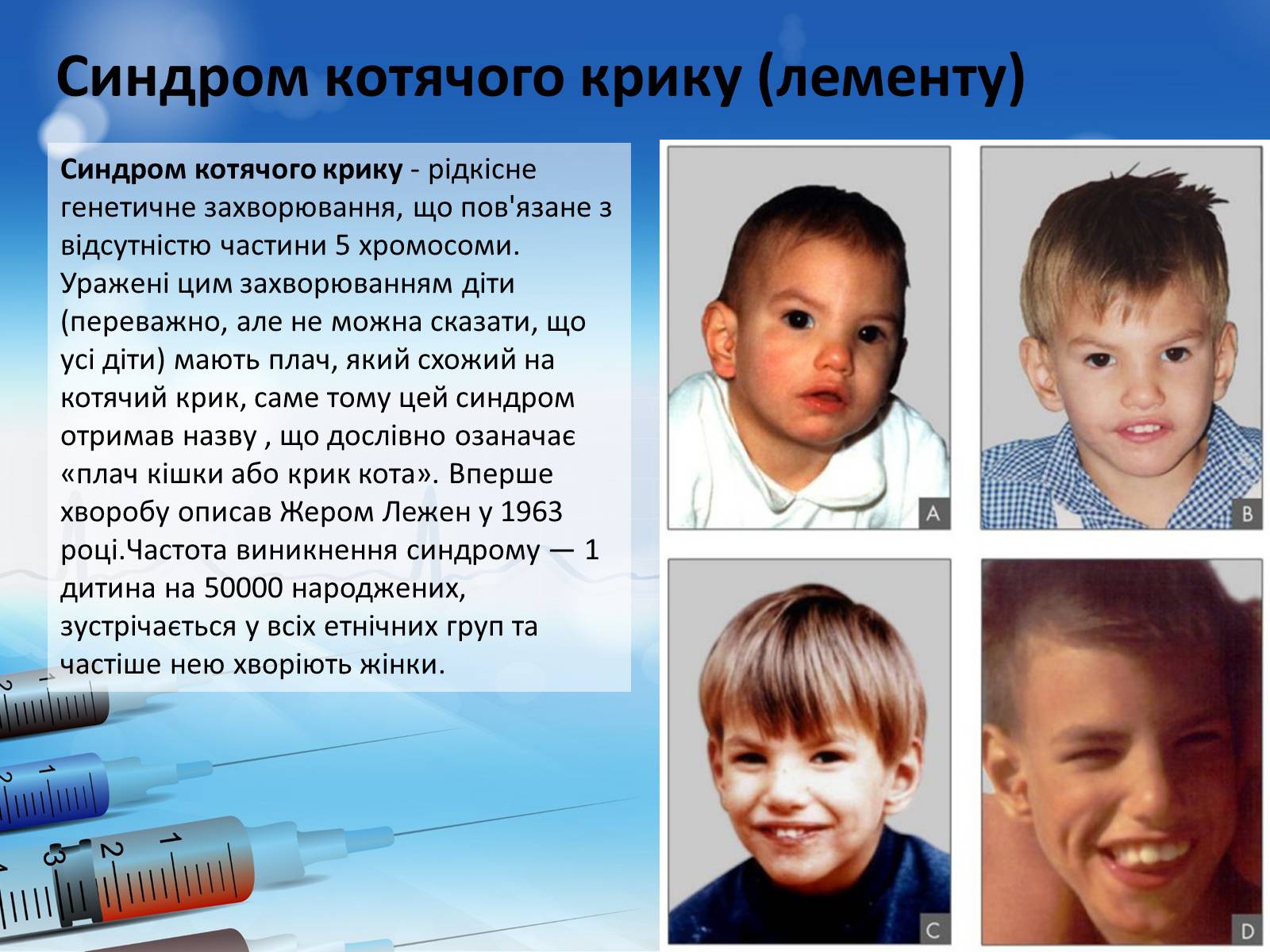 Презентація на тему «Спадкові хвороби» (варіант 2) - Слайд #9 Презентація на тему «Спадкові хвороби» (варіант 2) - Слайд #9
