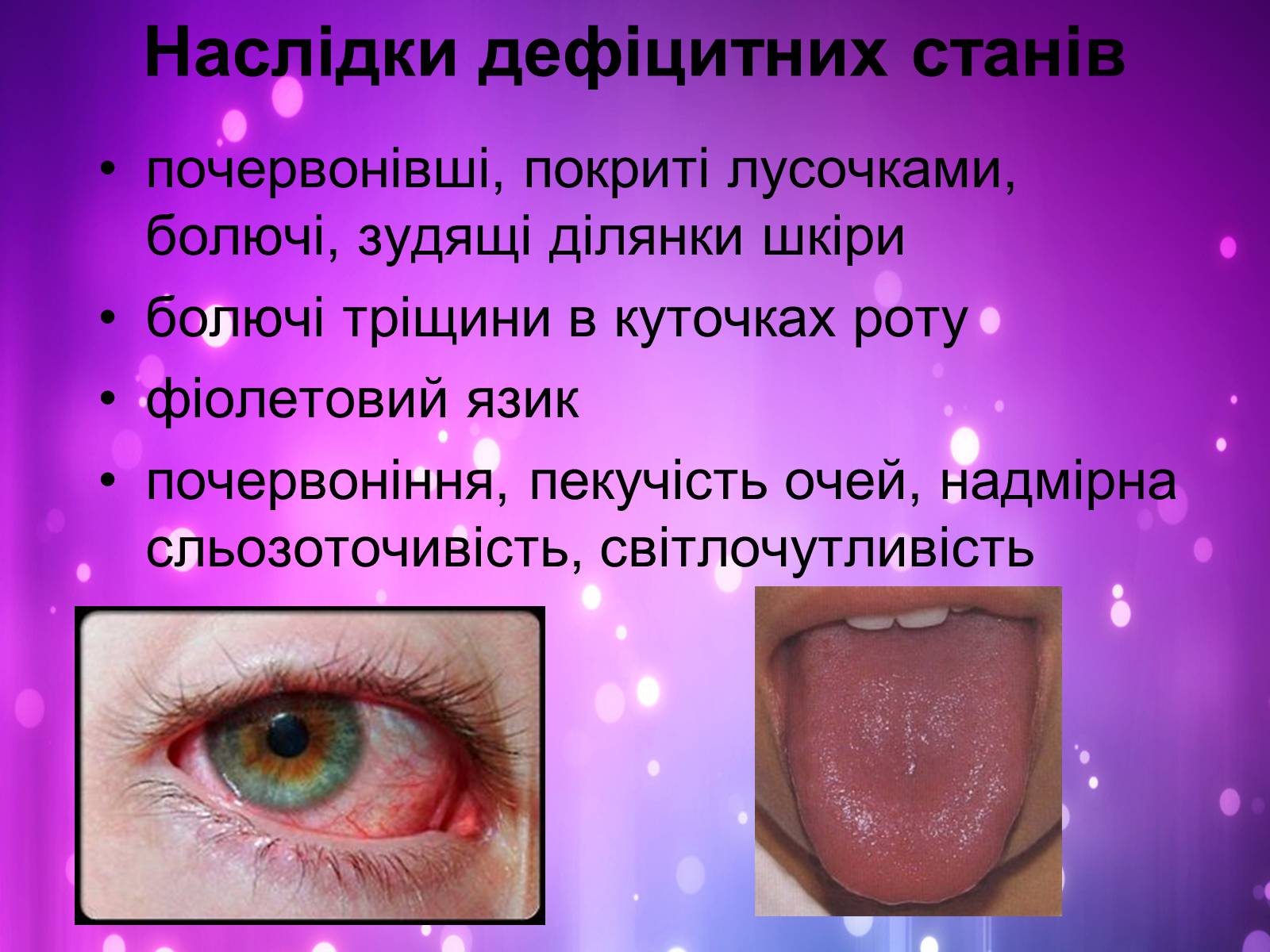 Презентація на тему «Вітаміни і їх роль в житті людини» (варіант 2) - Слайд #16 Презентація на тему «Вітаміни і їх роль в житті людини» (варіант 2) - Слайд #16