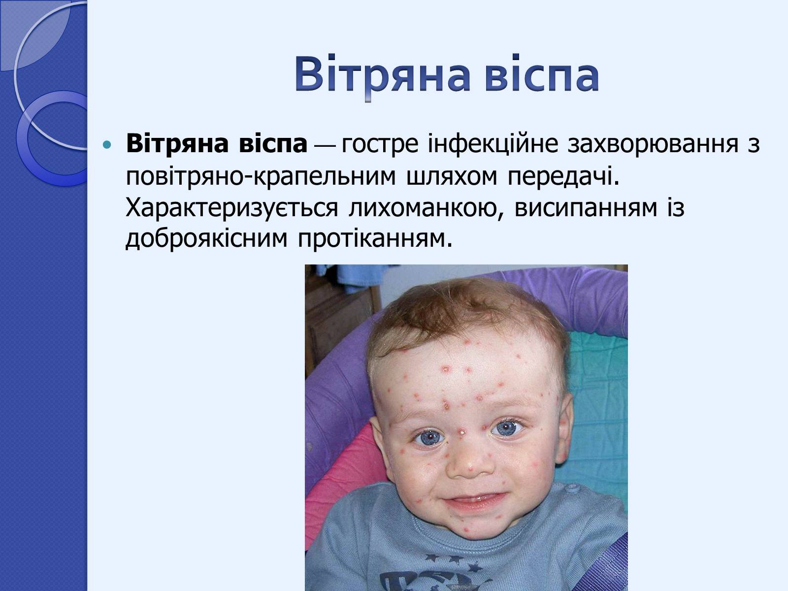 Презентація на тему «Інфекційні захворювання» (варіант 2) - Слайд #7
