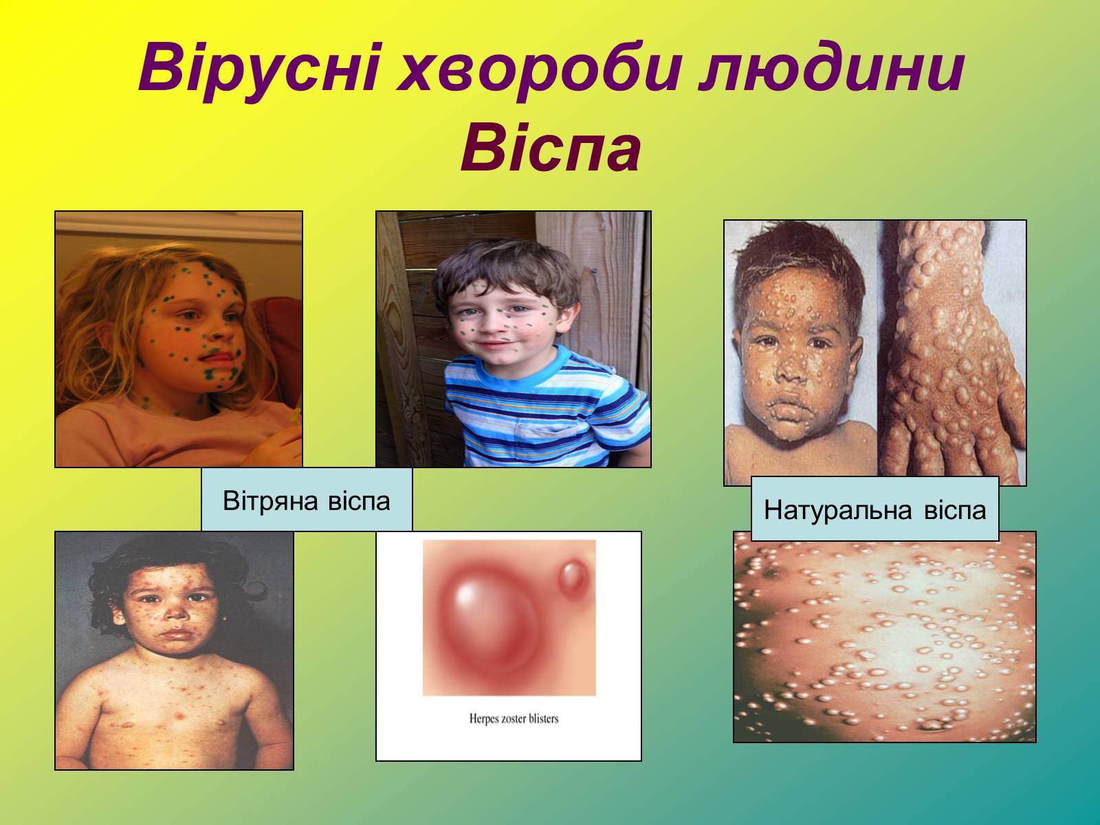 Презентація на тему «Віруси» (варіант 1) - Слайд #30 Презентація на тему «Віруси» (варіант 1) - Слайд #30