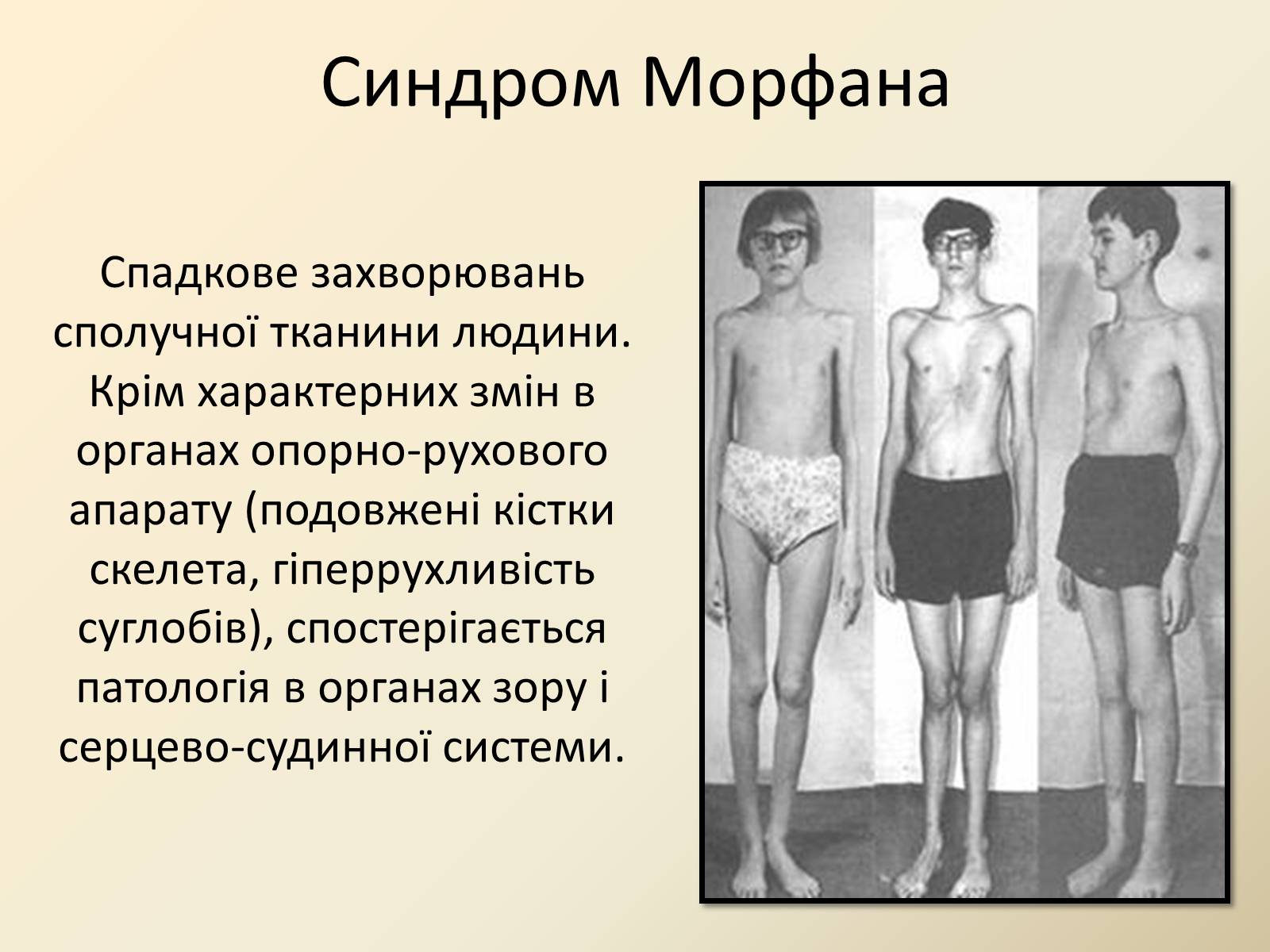 Презентація на тему «Генетика людини» (варіант 4) - Слайд #10 Презентація на тему «Генетика людини» (варіант 4) - Слайд #10