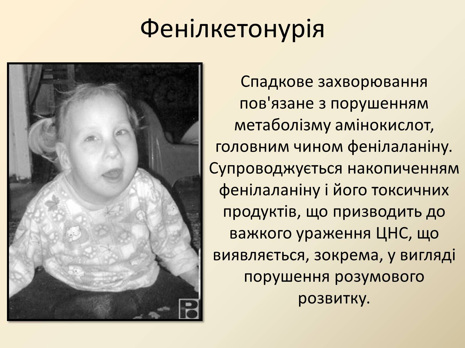 Презентація на тему «Генетика людини» (варіант 4) - Слайд #11 Презентація на тему «Генетика людини» (варіант 4) - Слайд #11