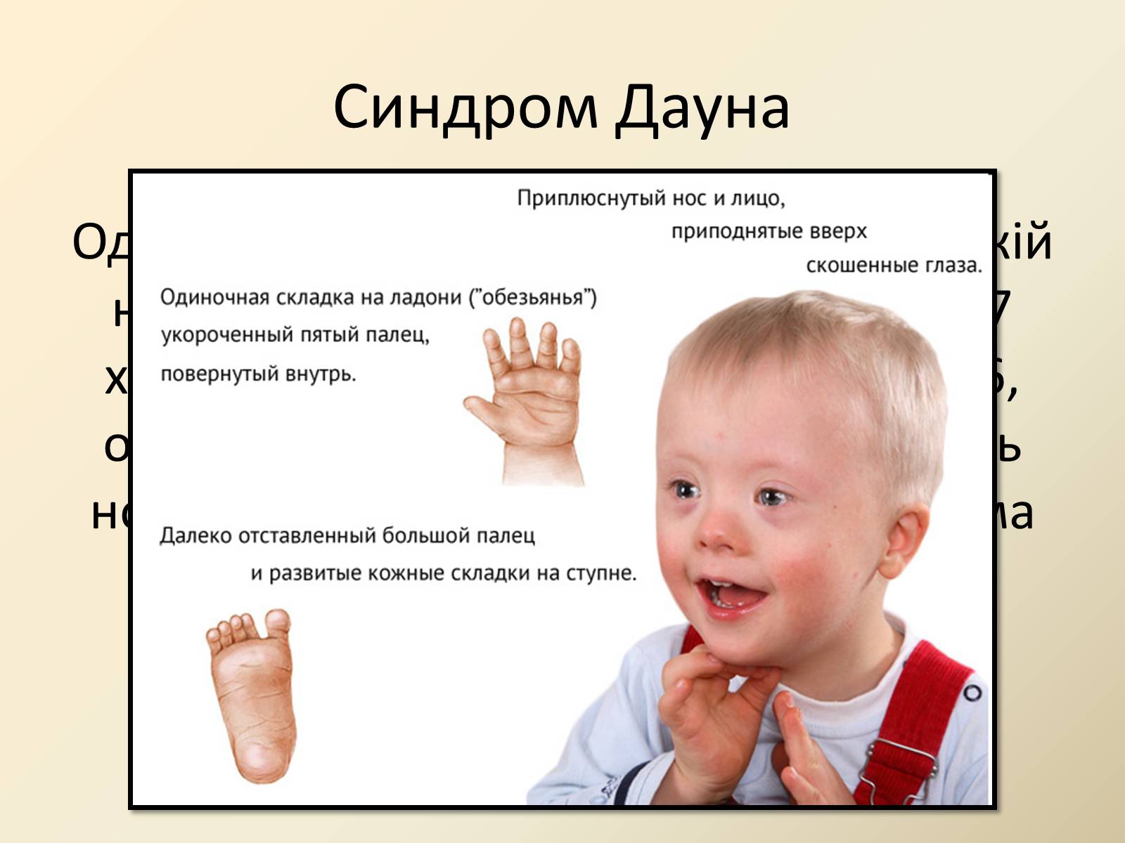 Презентація на тему «Генетика людини» (варіант 4) - Слайд #13 Презентація на тему «Генетика людини» (варіант 4) - Слайд #13