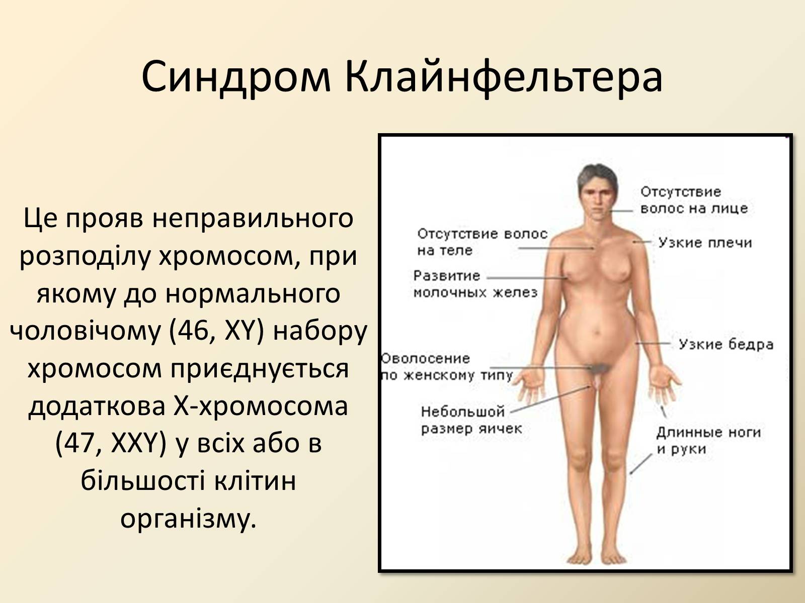 Презентація на тему «Генетика людини» (варіант 4) - Слайд #14 Презентація на тему «Генетика людини» (варіант 4) - Слайд #14