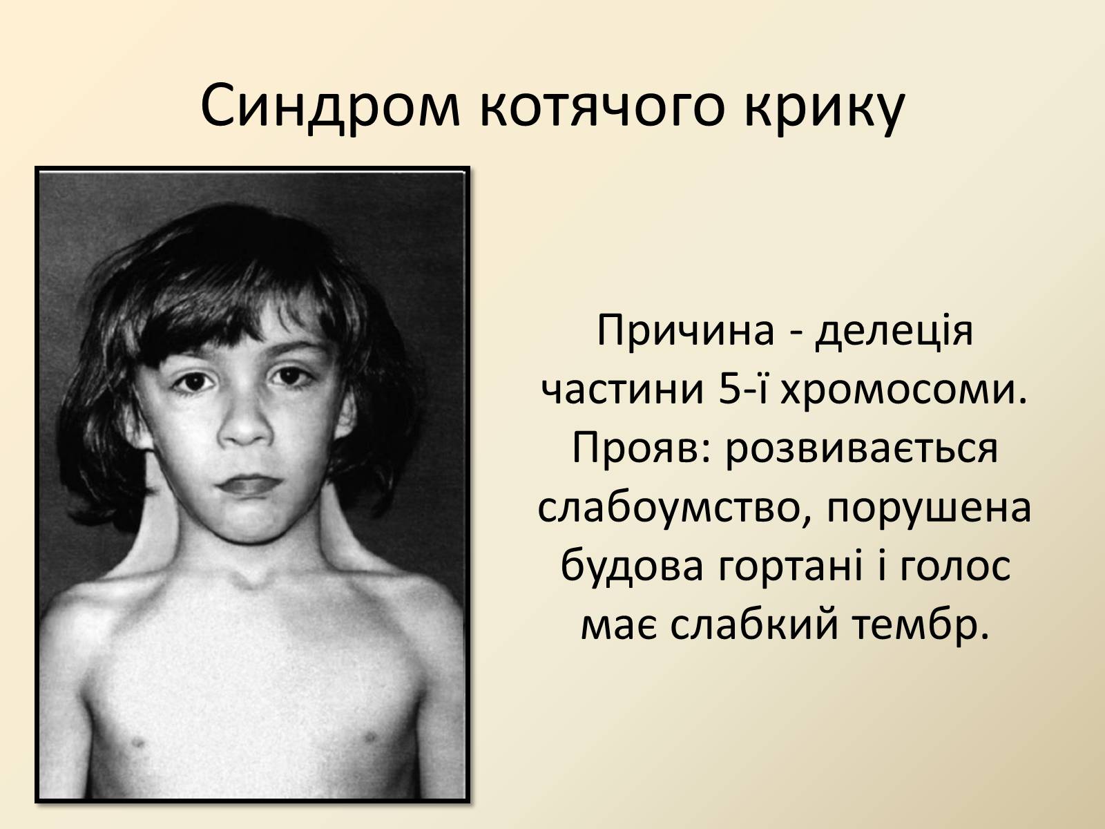 Презентація на тему «Генетика людини» (варіант 4) - Слайд #15 Презентація на тему «Генетика людини» (варіант 4) - Слайд #15