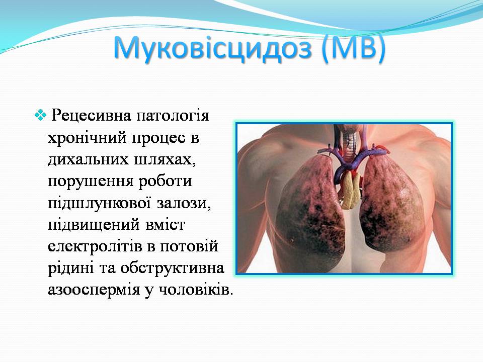 Презентація на тему «Генетичні захворювання» (варіант 2) - Слайд #7 Презентація на тему «Генетичні захворювання» (варіант 2) - Слайд #7
