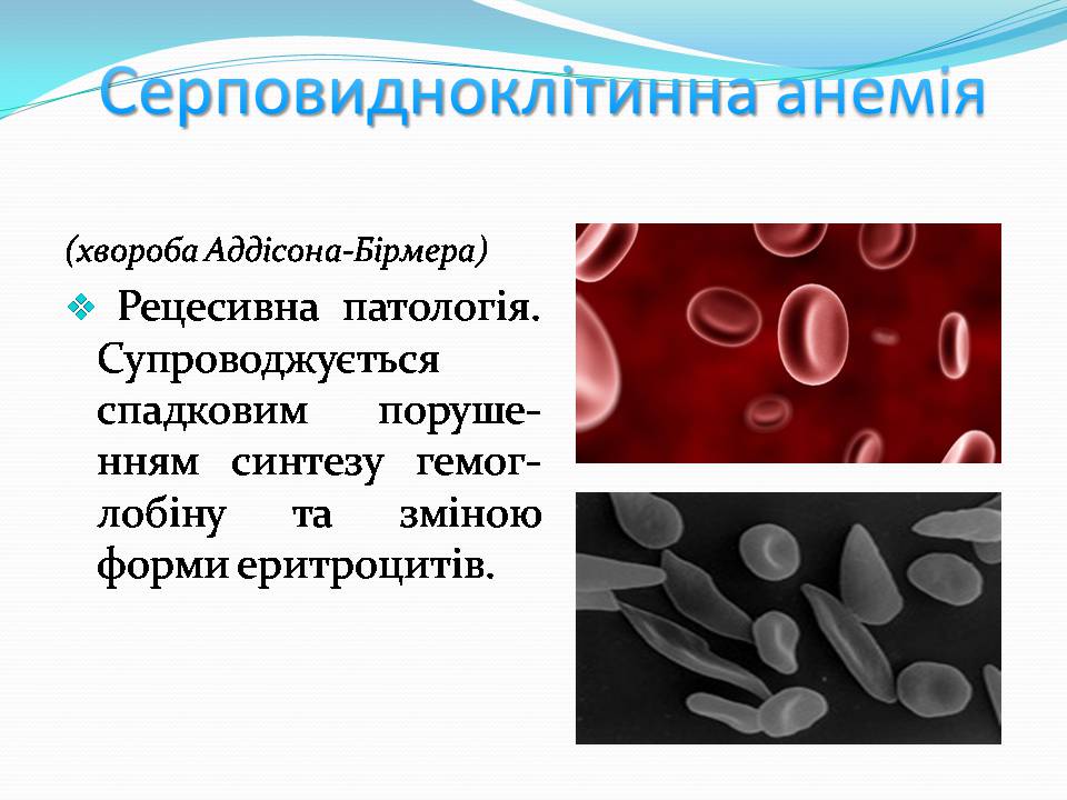 Презентація на тему «Генетичні захворювання» (варіант 2) - Слайд #8 Презентація на тему «Генетичні захворювання» (варіант 2) - Слайд #8
