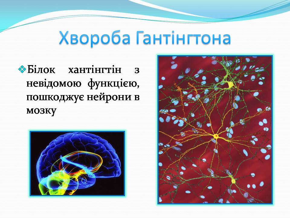 Презентація на тему «Генетичні захворювання» (варіант 2) - Слайд #9 Презентація на тему «Генетичні захворювання» (варіант 2) - Слайд #9