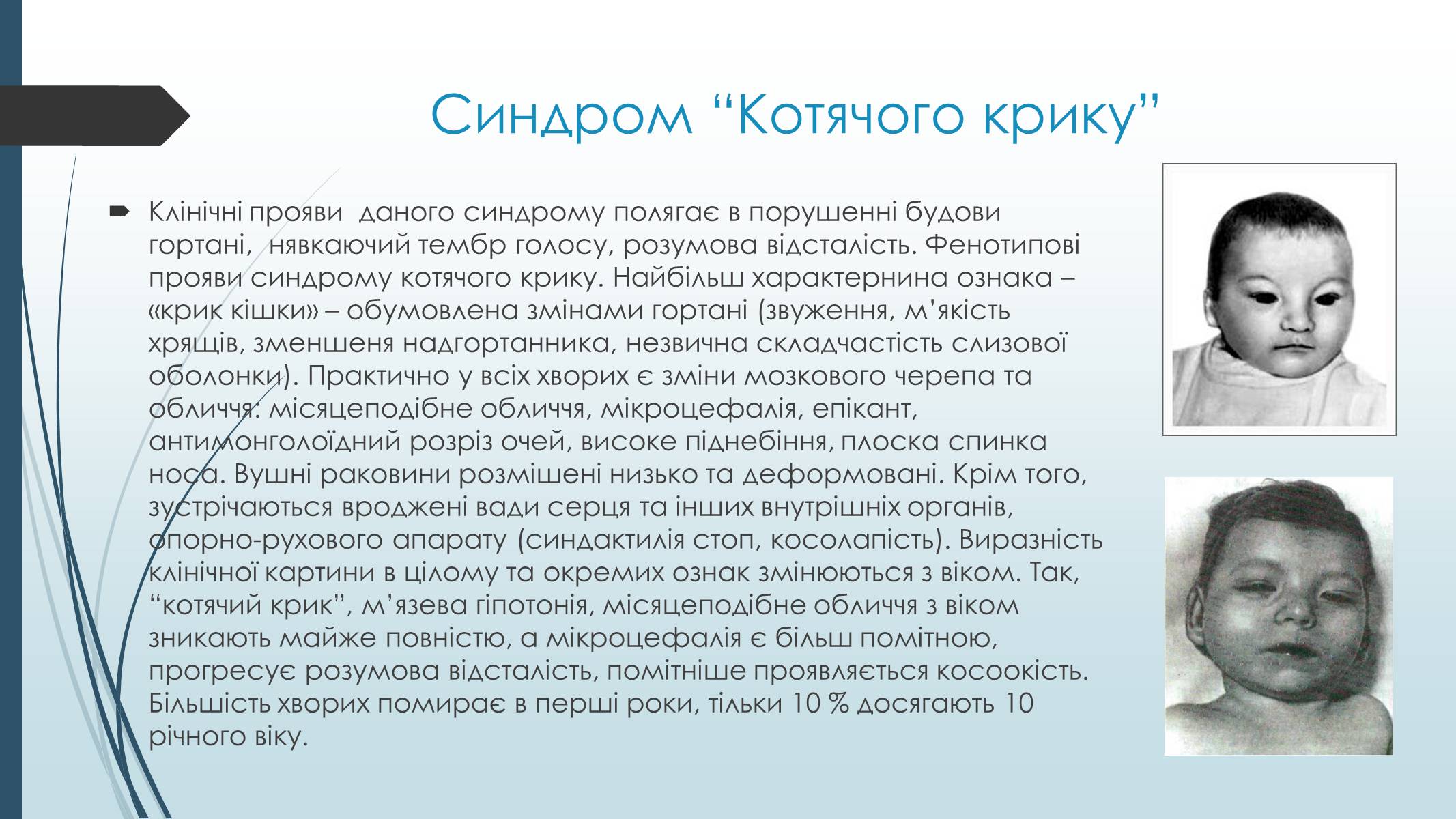 Презентація на тему «Хромосомні хвороби людини» - Слайд #10 Презентація на тему «Хромосомні хвороби людини» - Слайд #10
