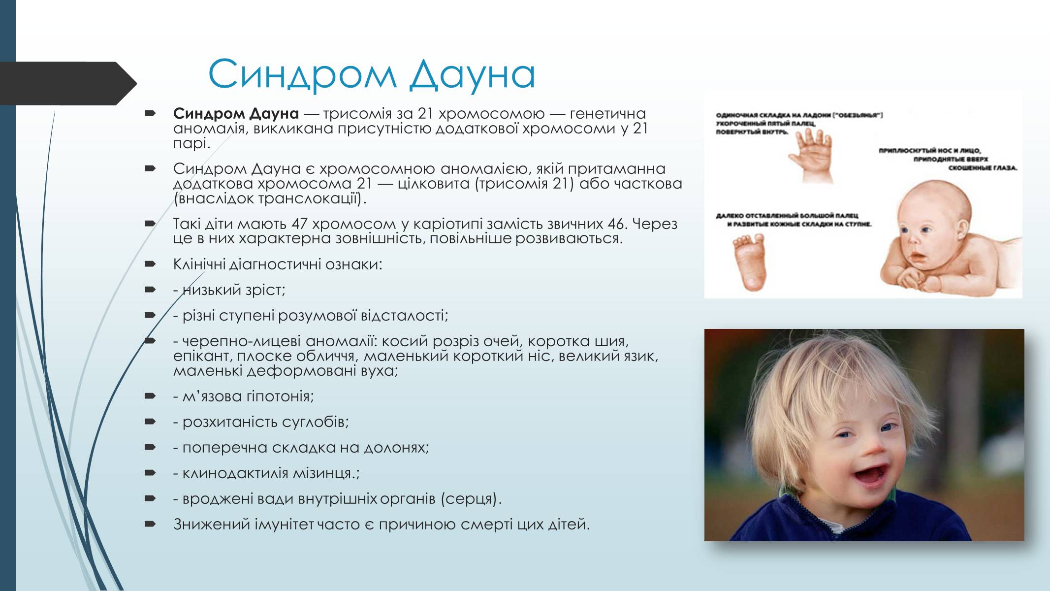 Презентація на тему «Хромосомні хвороби людини» - Слайд #3 Презентація на тему «Хромосомні хвороби людини» - Слайд #3