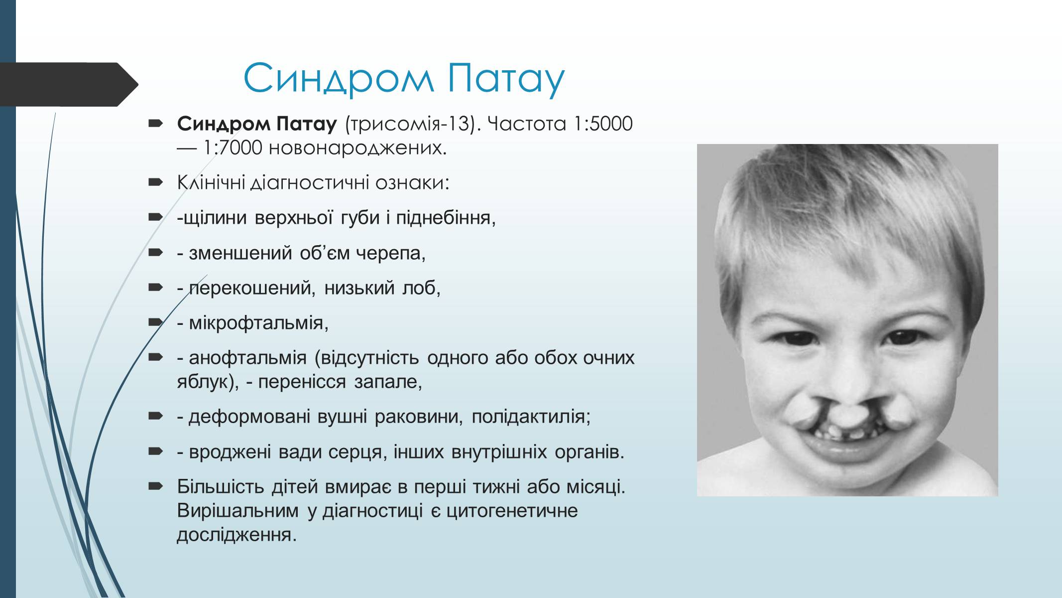 Презентація на тему «Хромосомні хвороби людини» - Слайд #4 Презентація на тему «Хромосомні хвороби людини» - Слайд #4
