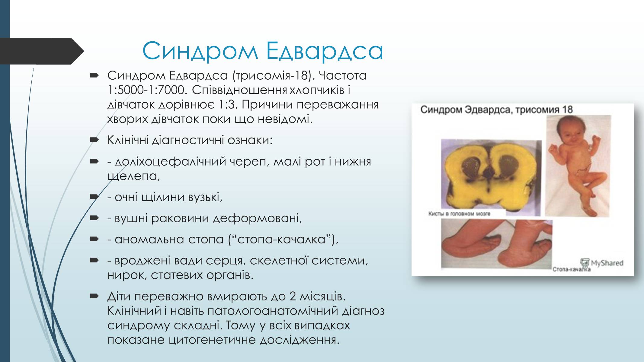 Презентація на тему «Хромосомні хвороби людини» - Слайд #5 Презентація на тему «Хромосомні хвороби людини» - Слайд #5