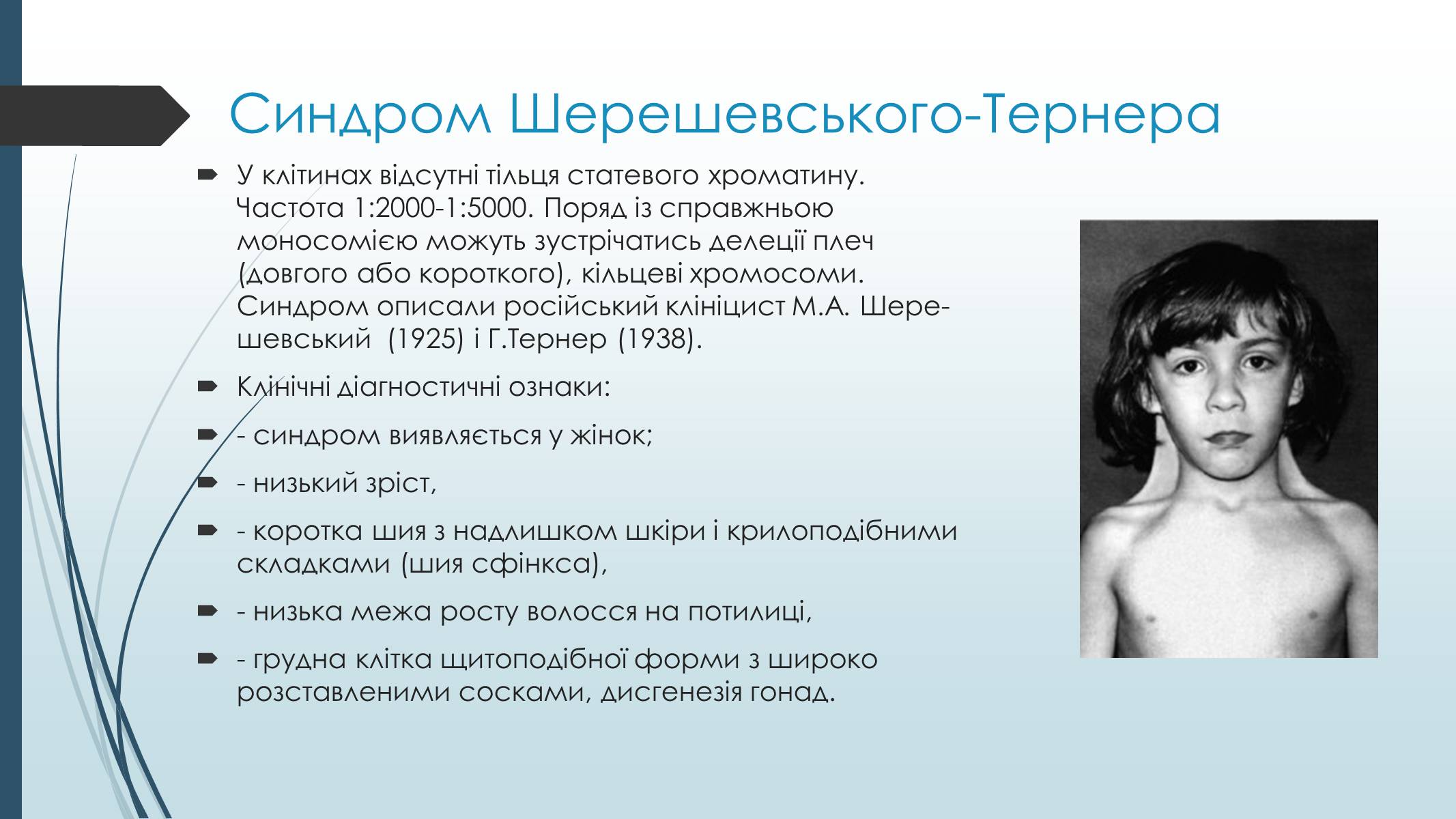 Презентація на тему «Хромосомні хвороби людини» - Слайд #6 Презентація на тему «Хромосомні хвороби людини» - Слайд #6