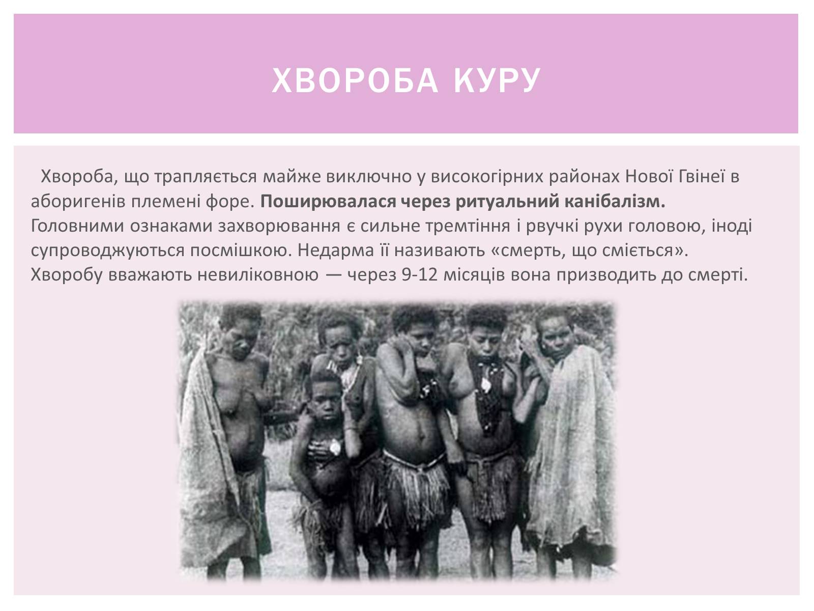 Презентація на тему «Пріони» (варіант 1) - Слайд #10 Презентація на тему «Пріони» (варіант 1) - Слайд #10