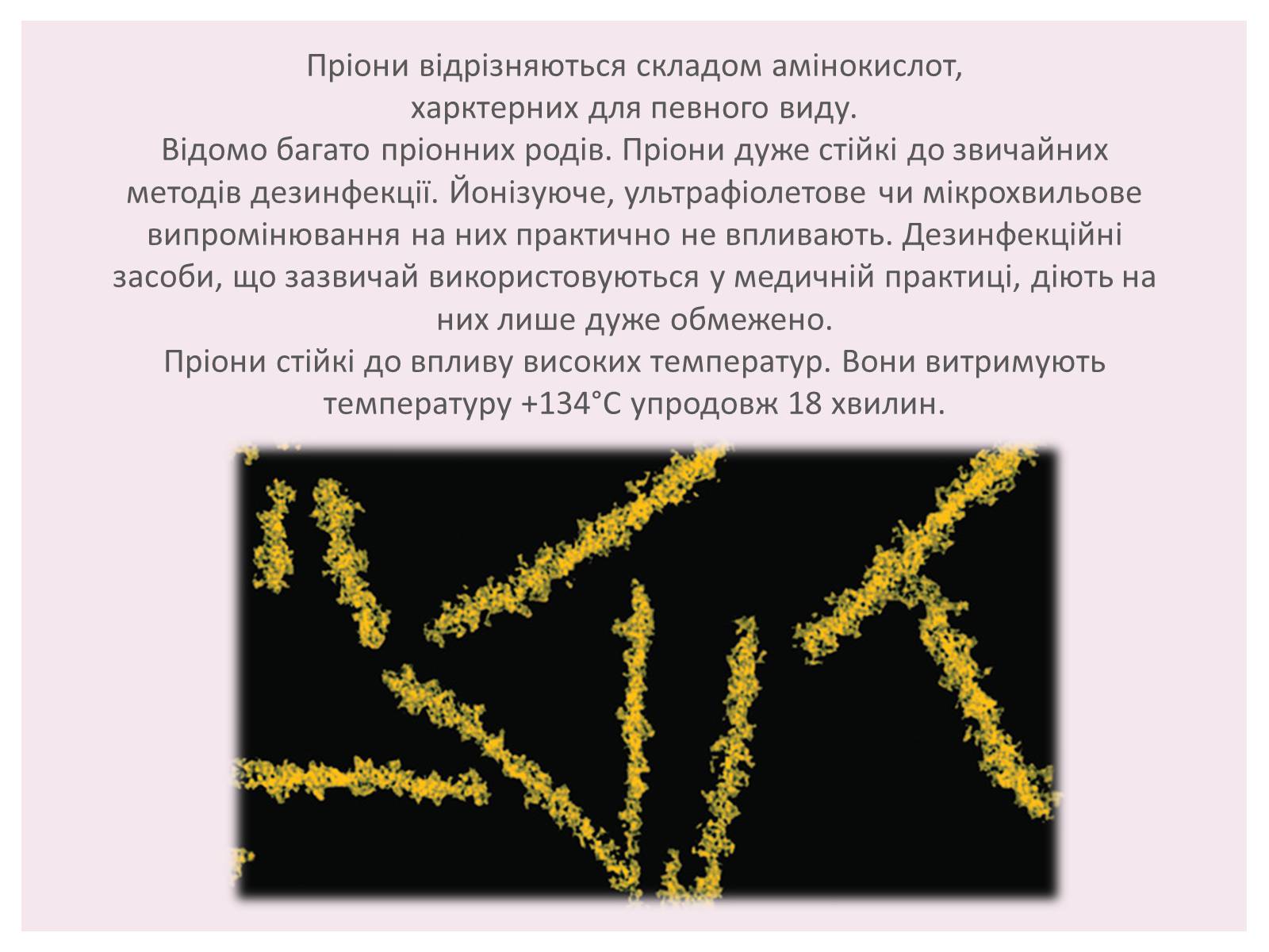 Презентація на тему «Пріони» (варіант 1) - Слайд #11 Презентація на тему «Пріони» (варіант 1) - Слайд #11