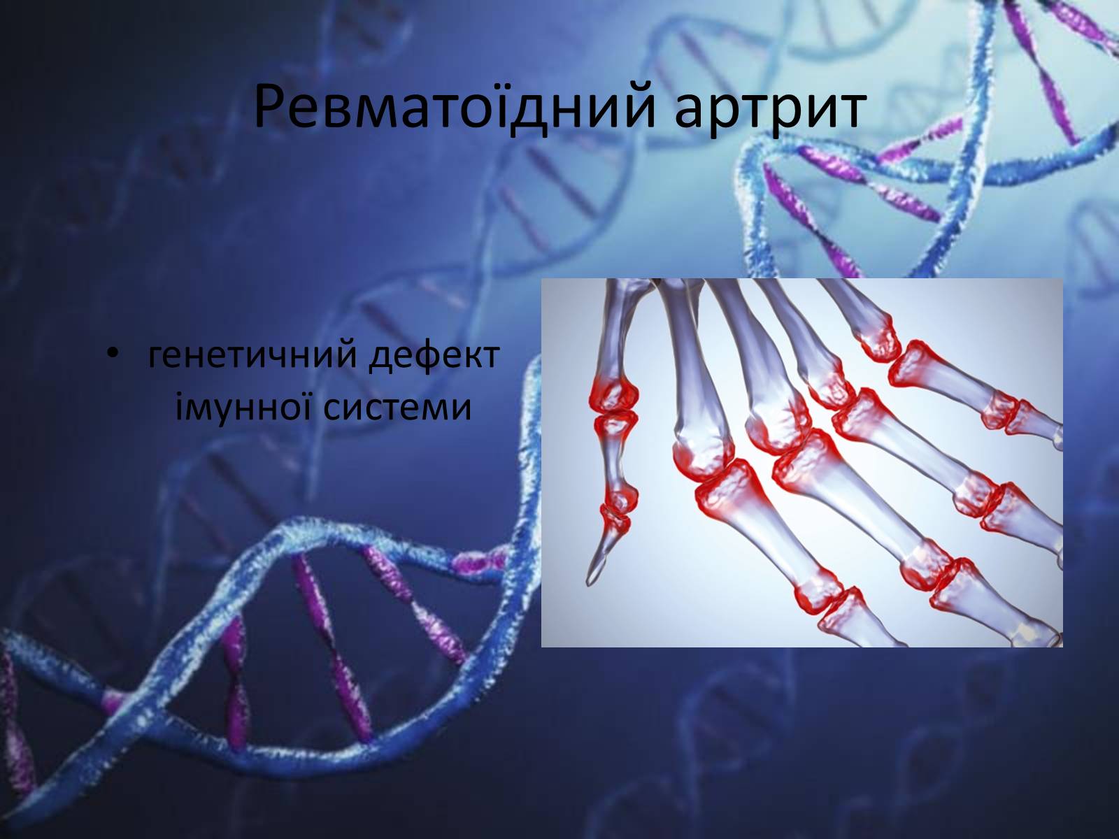 Презентація на тему «Генетичні захворювання людини» - Слайд #11 Презентація на тему «Генетичні захворювання людини» - Слайд #11