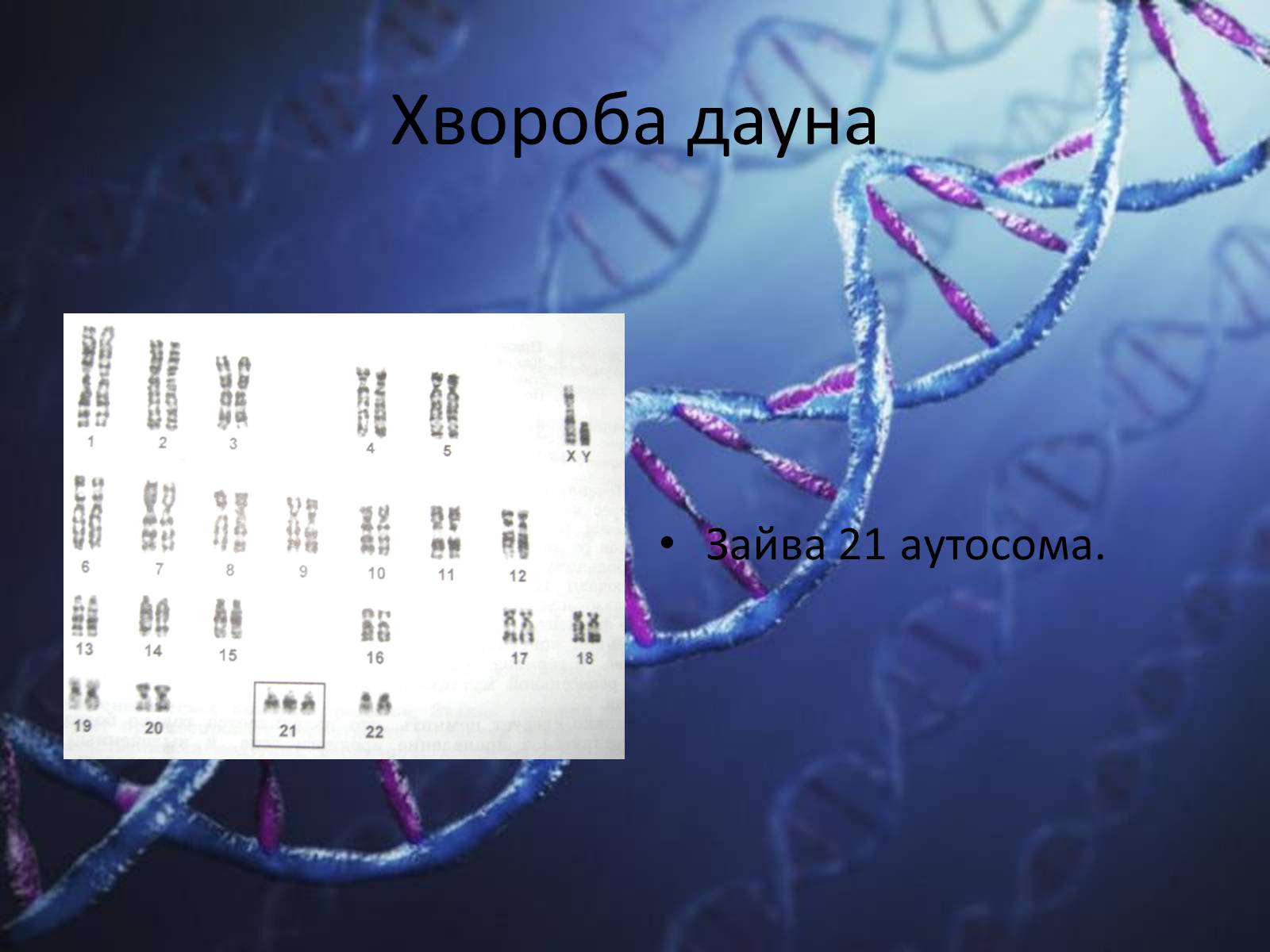 Презентація на тему «Генетичні захворювання людини» - Слайд #13 Презентація на тему «Генетичні захворювання людини» - Слайд #13