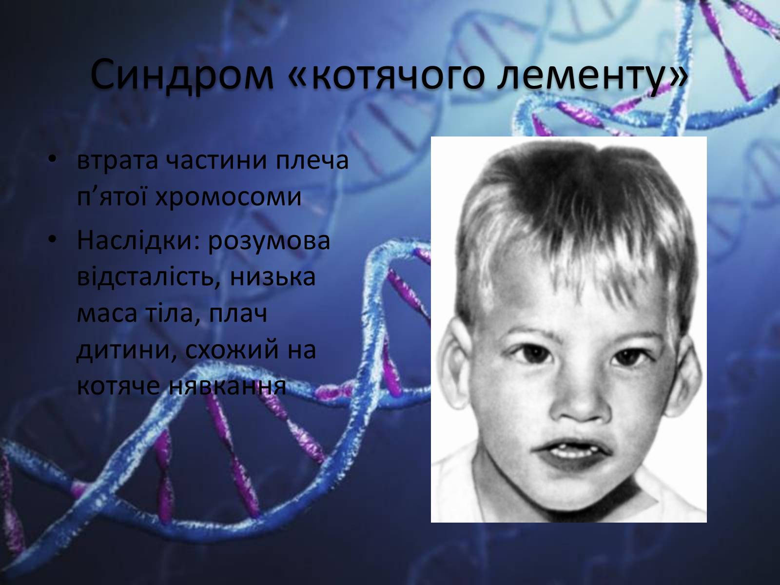 Презентація на тему «Генетичні захворювання людини» - Слайд #14 Презентація на тему «Генетичні захворювання людини» - Слайд #14