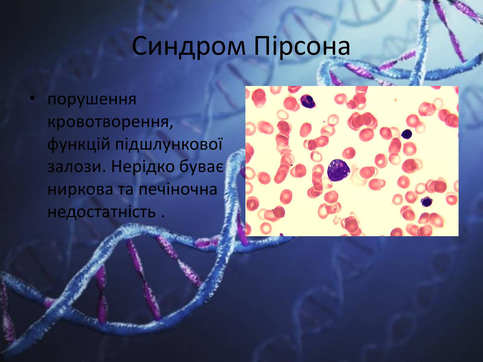 Презентація на тему «Генетичні захворювання людини» - Слайд #16 Презентація на тему «Генетичні захворювання людини» - Слайд #16