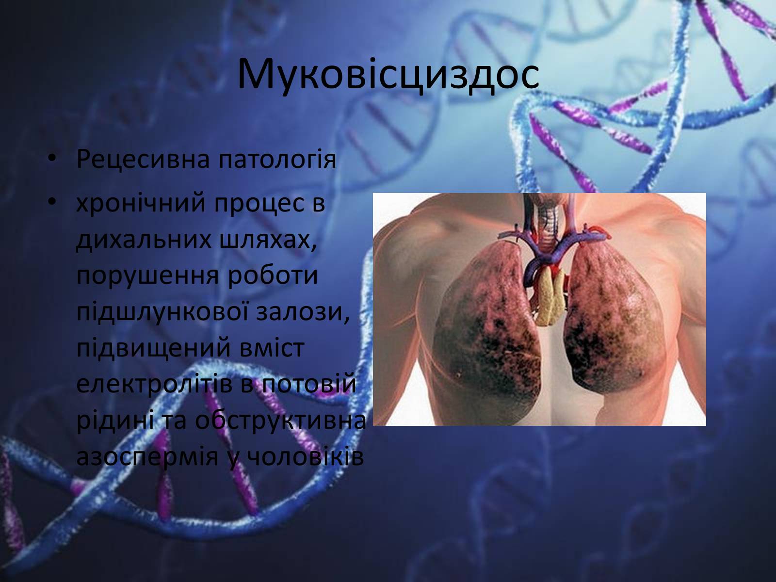 Презентація на тему «Генетичні захворювання людини» - Слайд #4 Презентація на тему «Генетичні захворювання людини» - Слайд #4