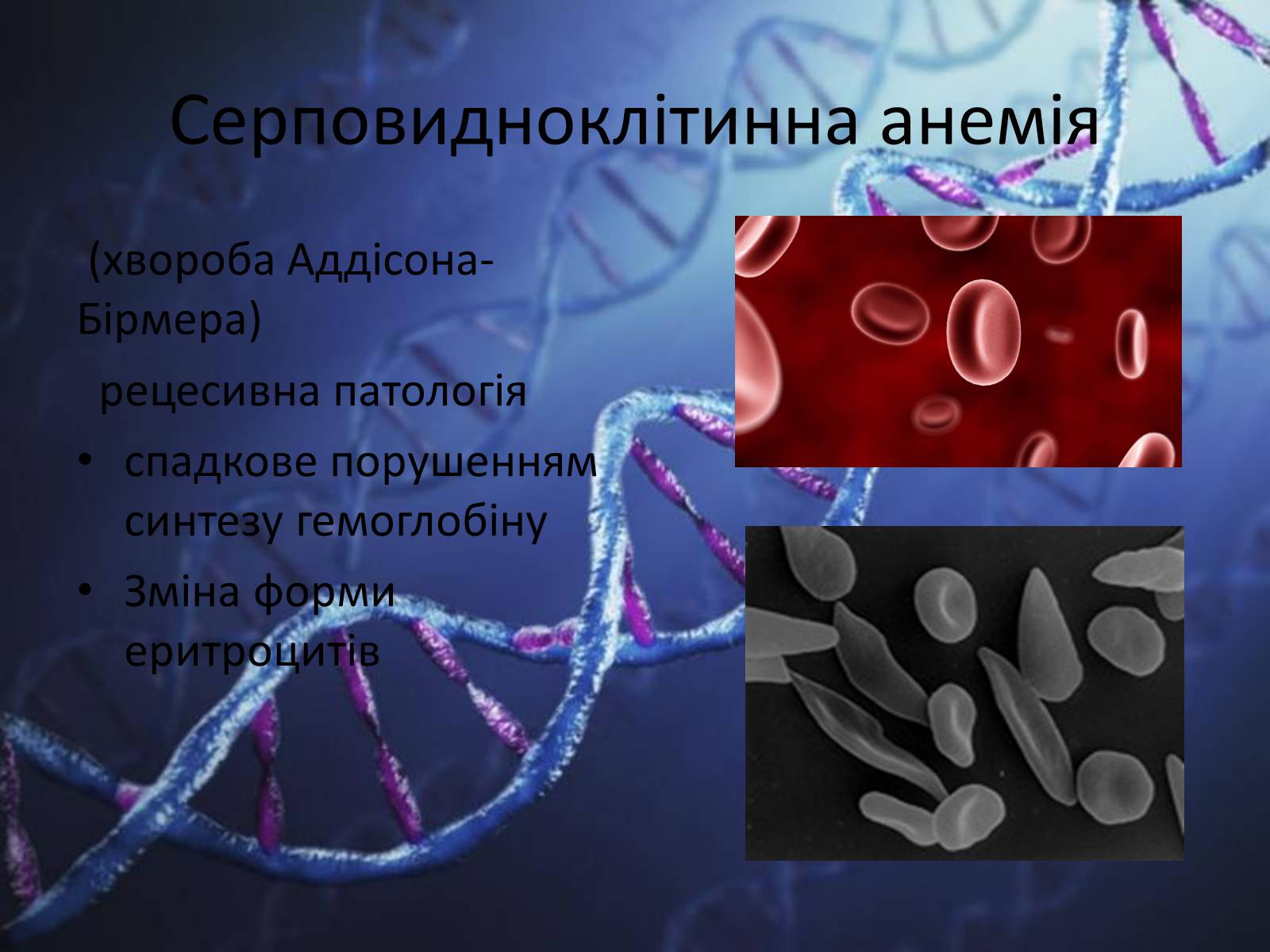 Презентація на тему «Генетичні захворювання людини» - Слайд #5 Презентація на тему «Генетичні захворювання людини» - Слайд #5
