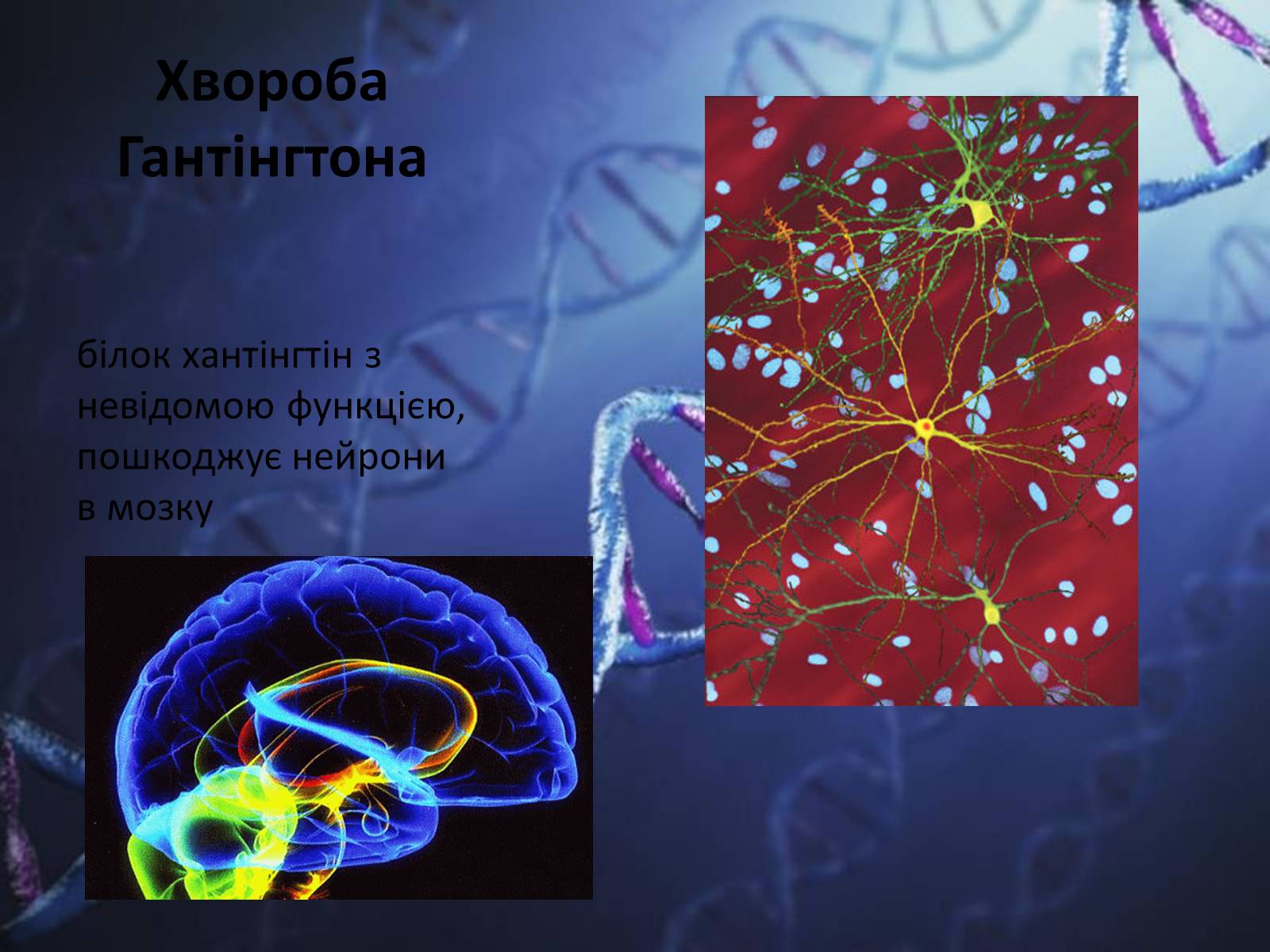 Презентація на тему «Генетичні захворювання людини» - Слайд #6 Презентація на тему «Генетичні захворювання людини» - Слайд #6