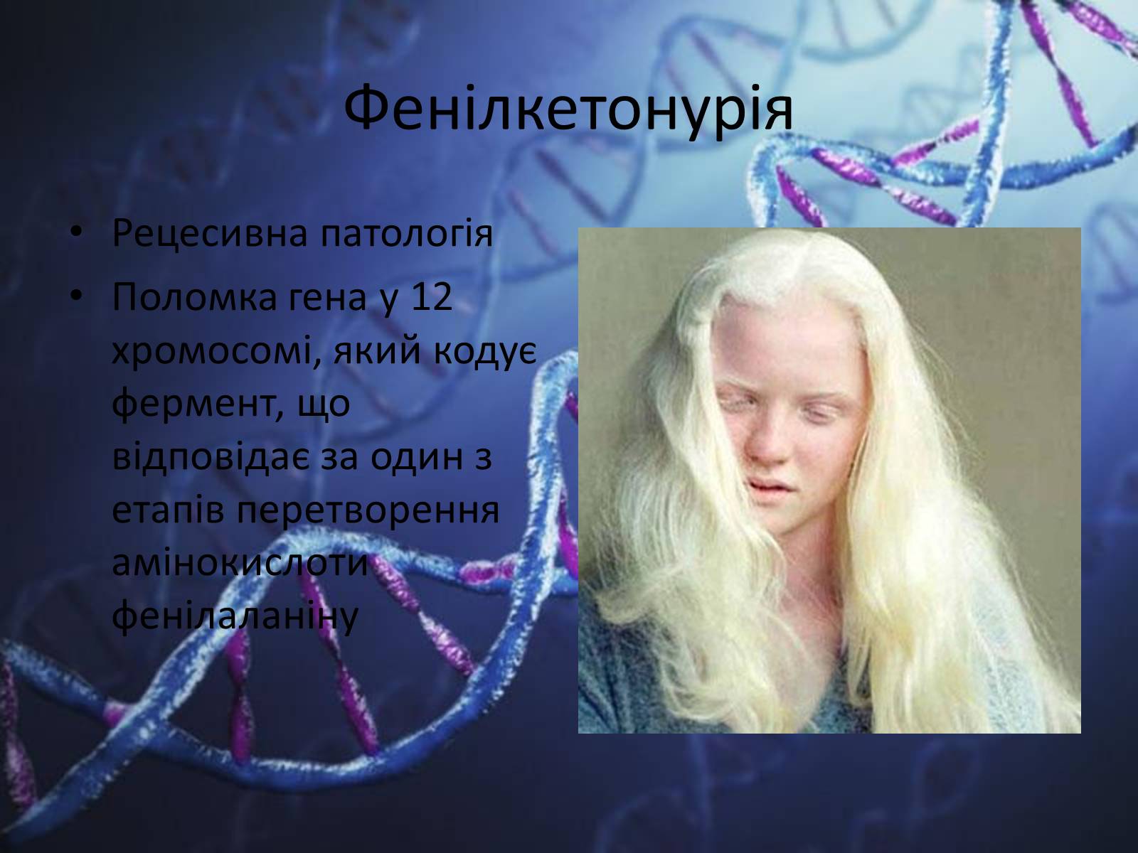 Презентація на тему «Генетичні захворювання людини» - Слайд #7 Презентація на тему «Генетичні захворювання людини» - Слайд #7