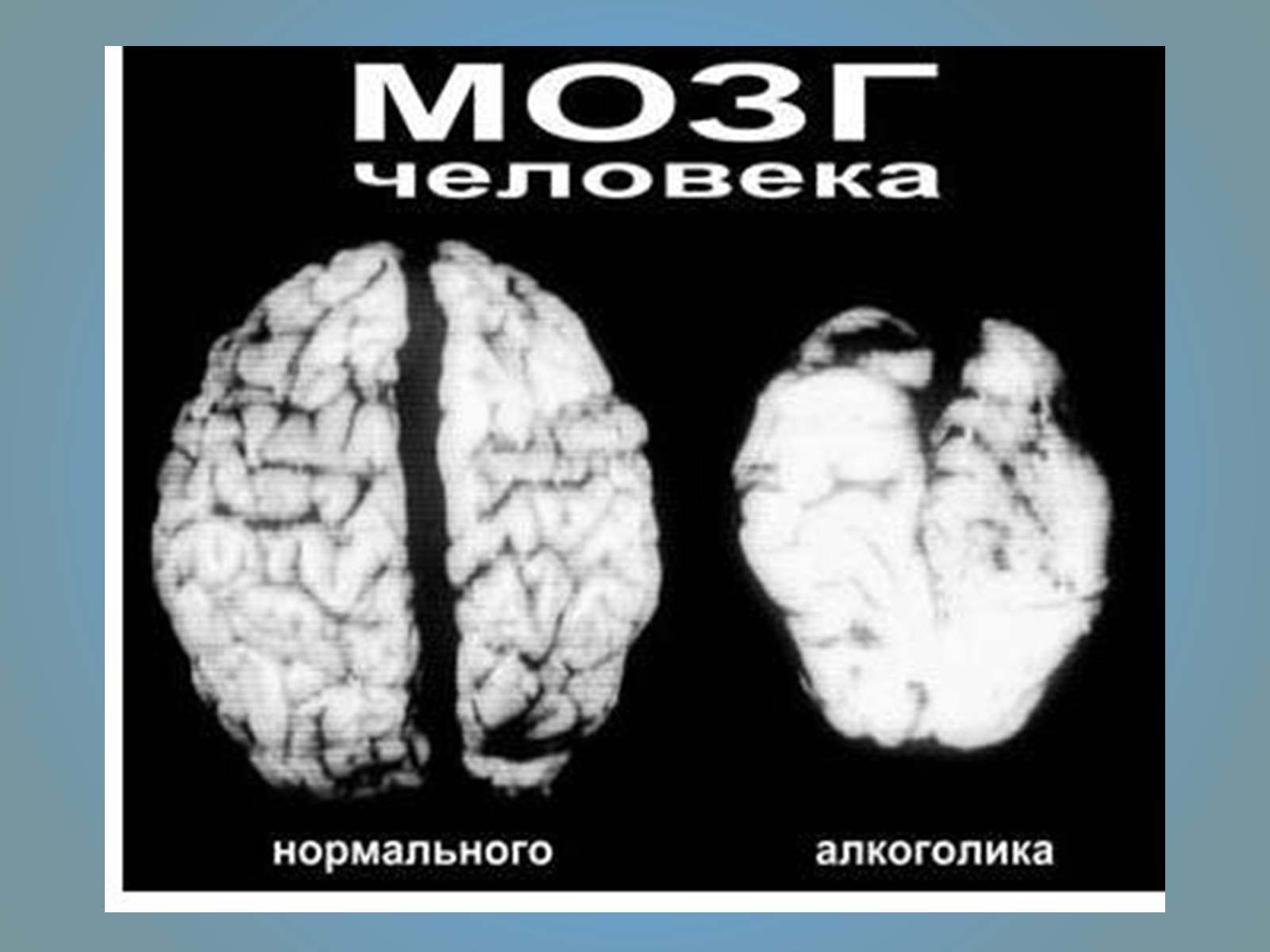 Презентація на тему «Воздействие вредных веществ на организм человека» - Слайд #21 Презентація на тему «Воздействие вредных веществ на организм человека» - Слайд #21