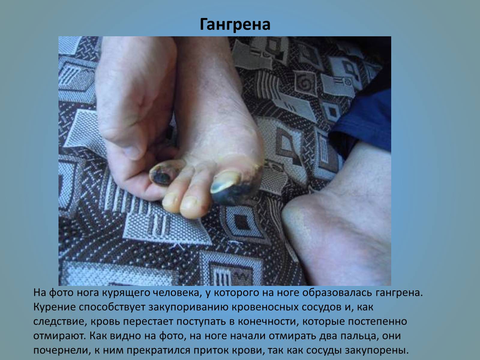 Презентація на тему «Воздействие вредных веществ на организм человека» - Слайд #43 Презентація на тему «Воздействие вредных веществ на организм человека» - Слайд #43