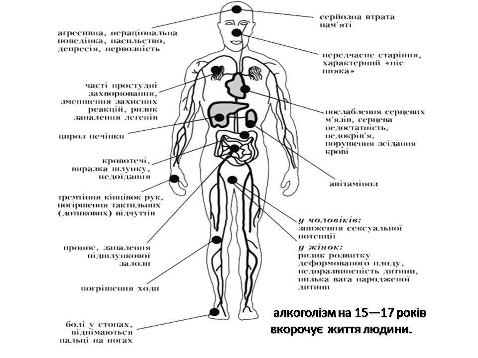 Презентація на тему «Шкідливий вплив алкоголю на організм людини» - Слайд #6 Презентація на тему «Шкідливий вплив алкоголю на організм людини» - Слайд #6
