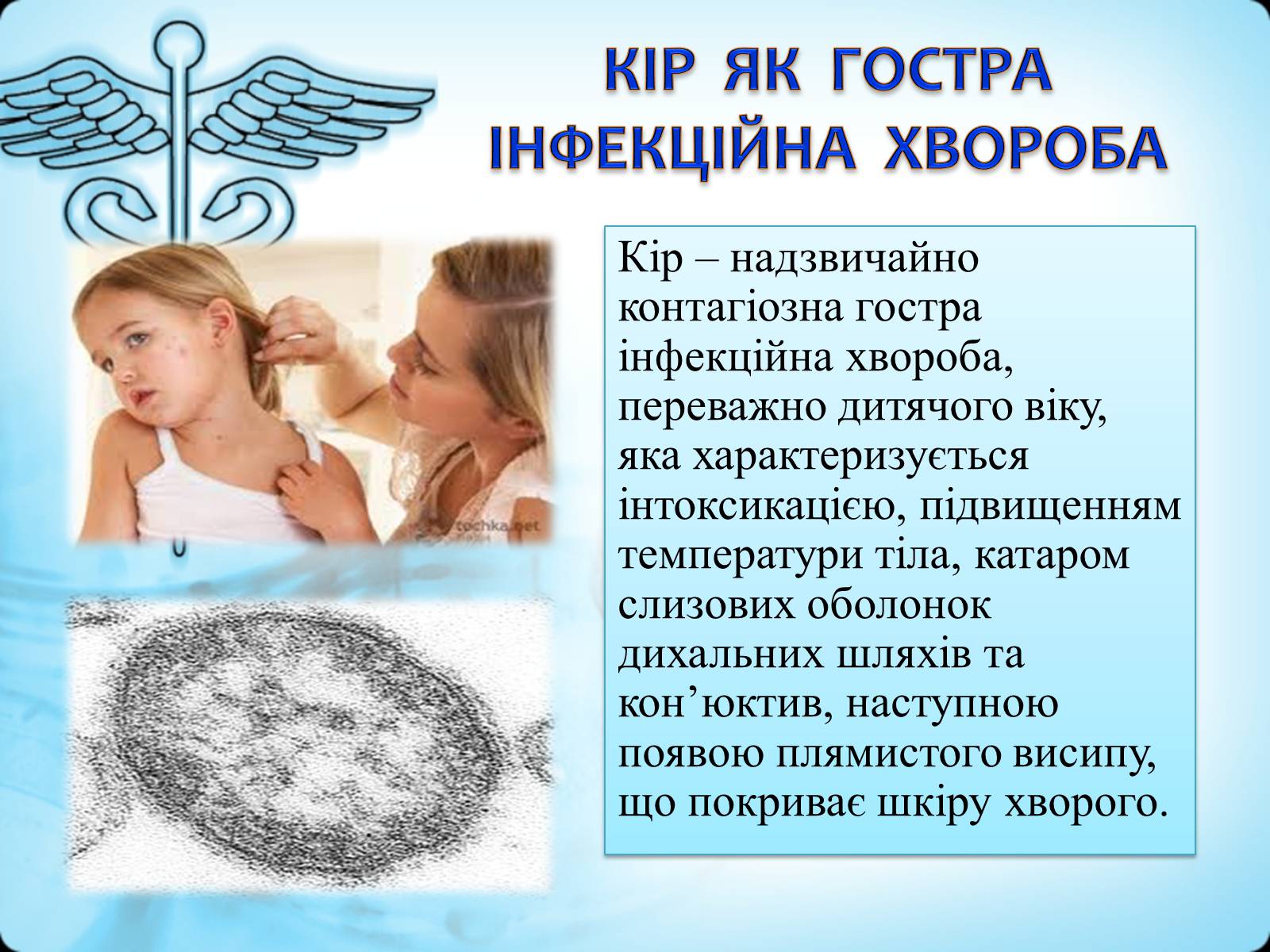 Презентація на тему «Кір» (варіант 2) - Слайд #2 Презентація на тему «Кір» (варіант 2) - Слайд #2