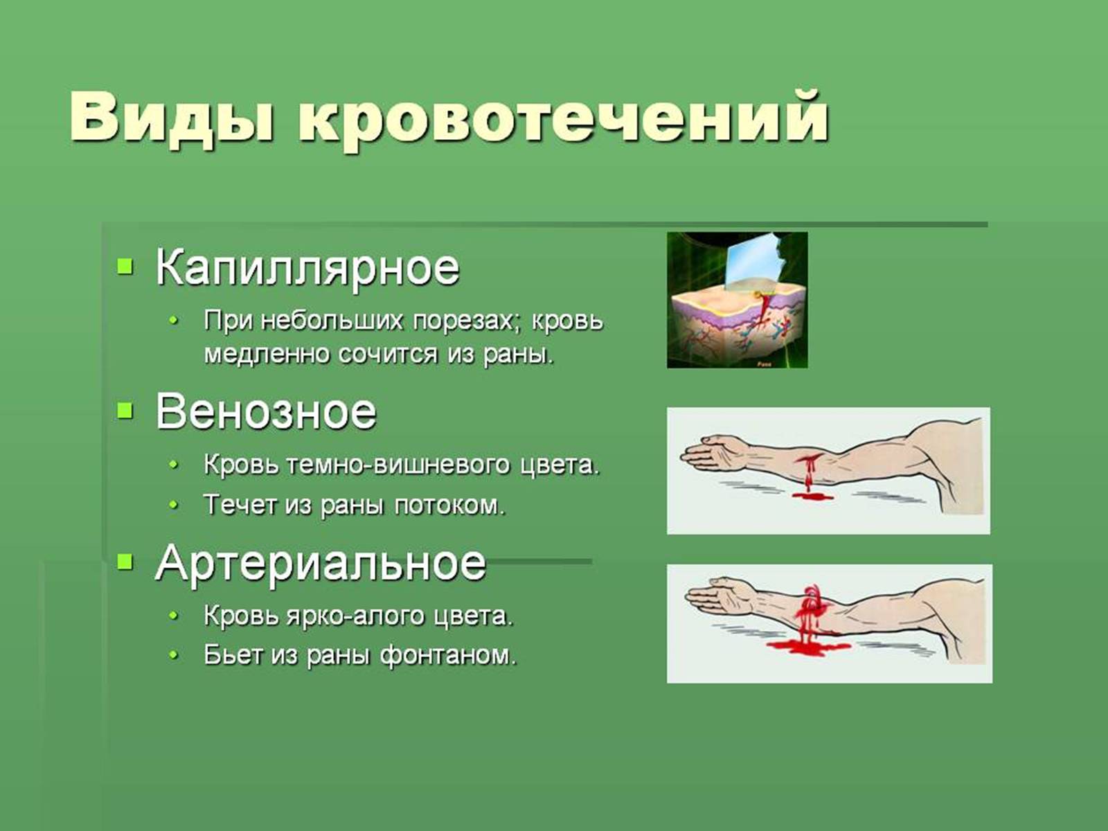 Презентація на тему «Кровоносна система» (варіант 1) - Слайд #24 Презентація на тему «Кровоносна система» (варіант 1) - Слайд #24