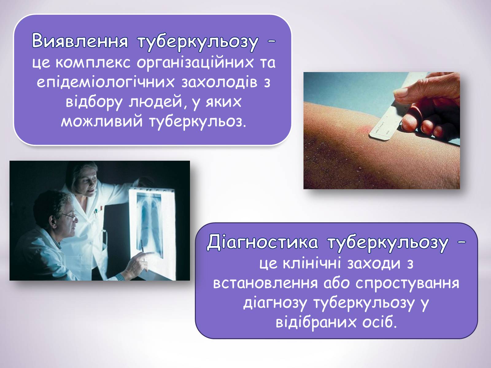 Презентація на тему «Туберкульоз» (варіант 6) - Слайд #10 Презентація на тему «Туберкульоз» (варіант 6) - Слайд #10
