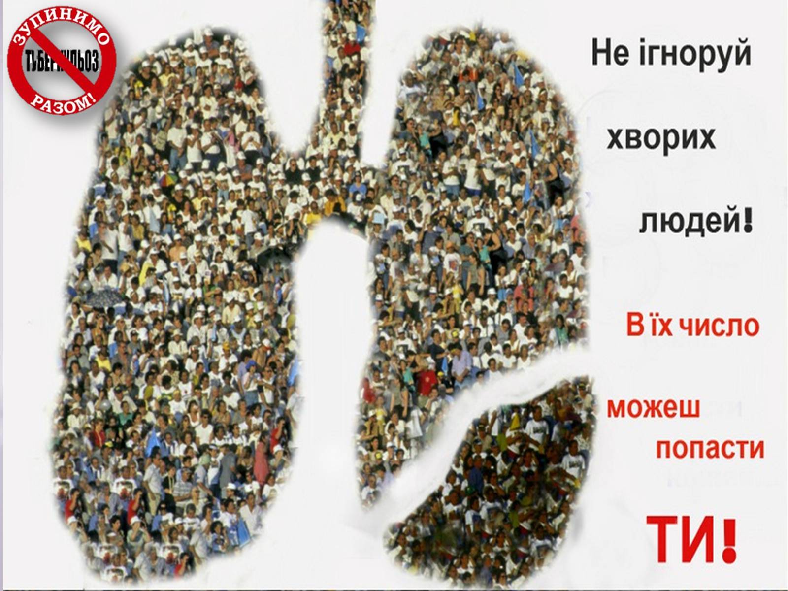 Презентація на тему «Туберкульоз» (варіант 6) - Слайд #16 Презентація на тему «Туберкульоз» (варіант 6) - Слайд #16